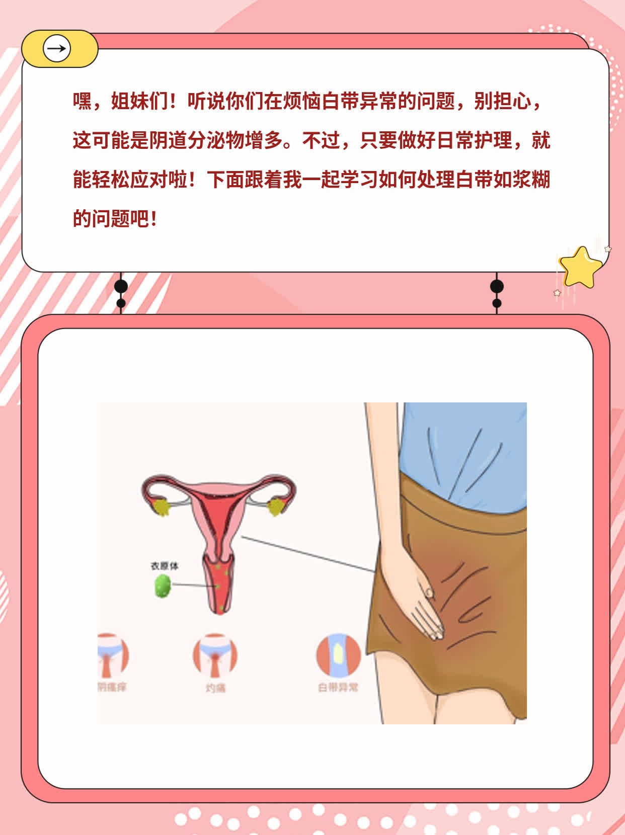 白带如浆糊：女性常见问题解析