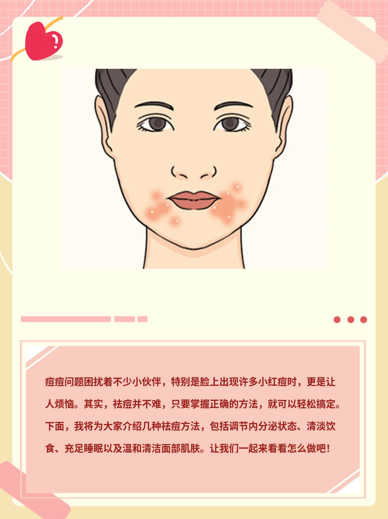 「祛痘攻略」：搞定脸上小红痘的N种方法！