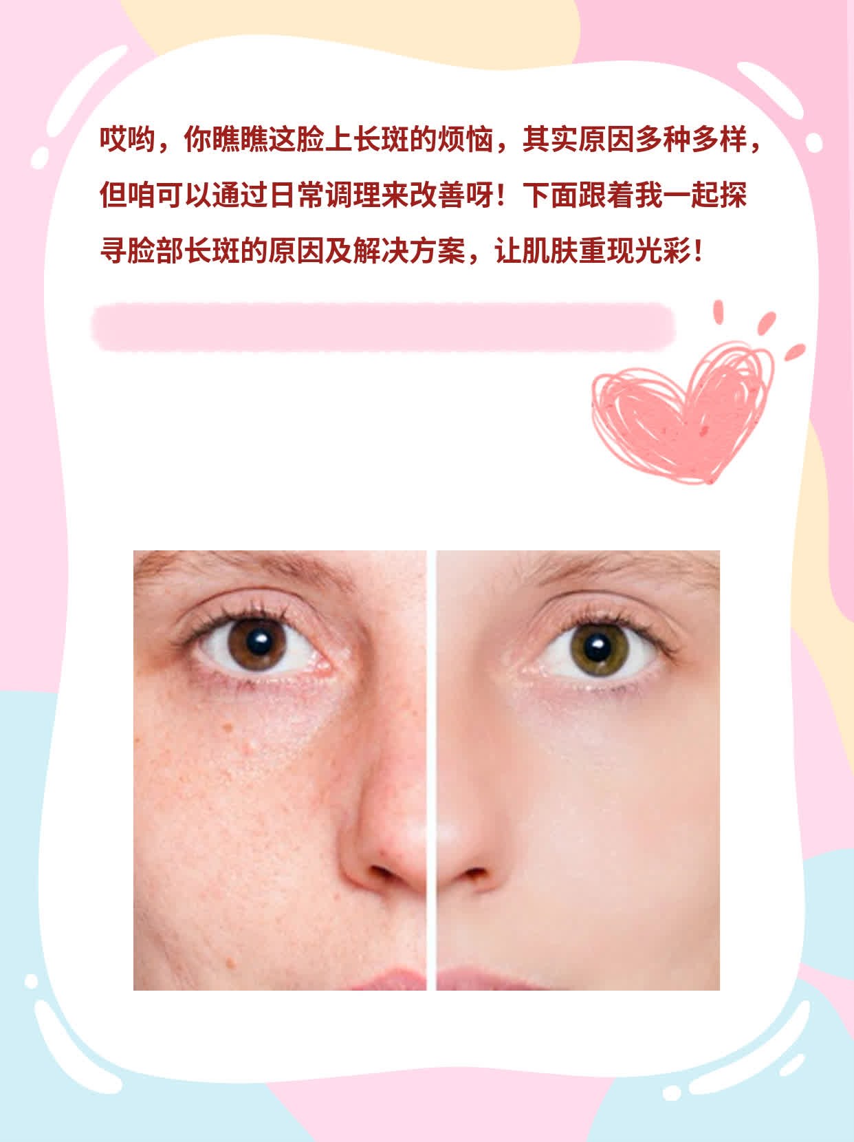 揭秘：脸部长斑的原因及解决方案