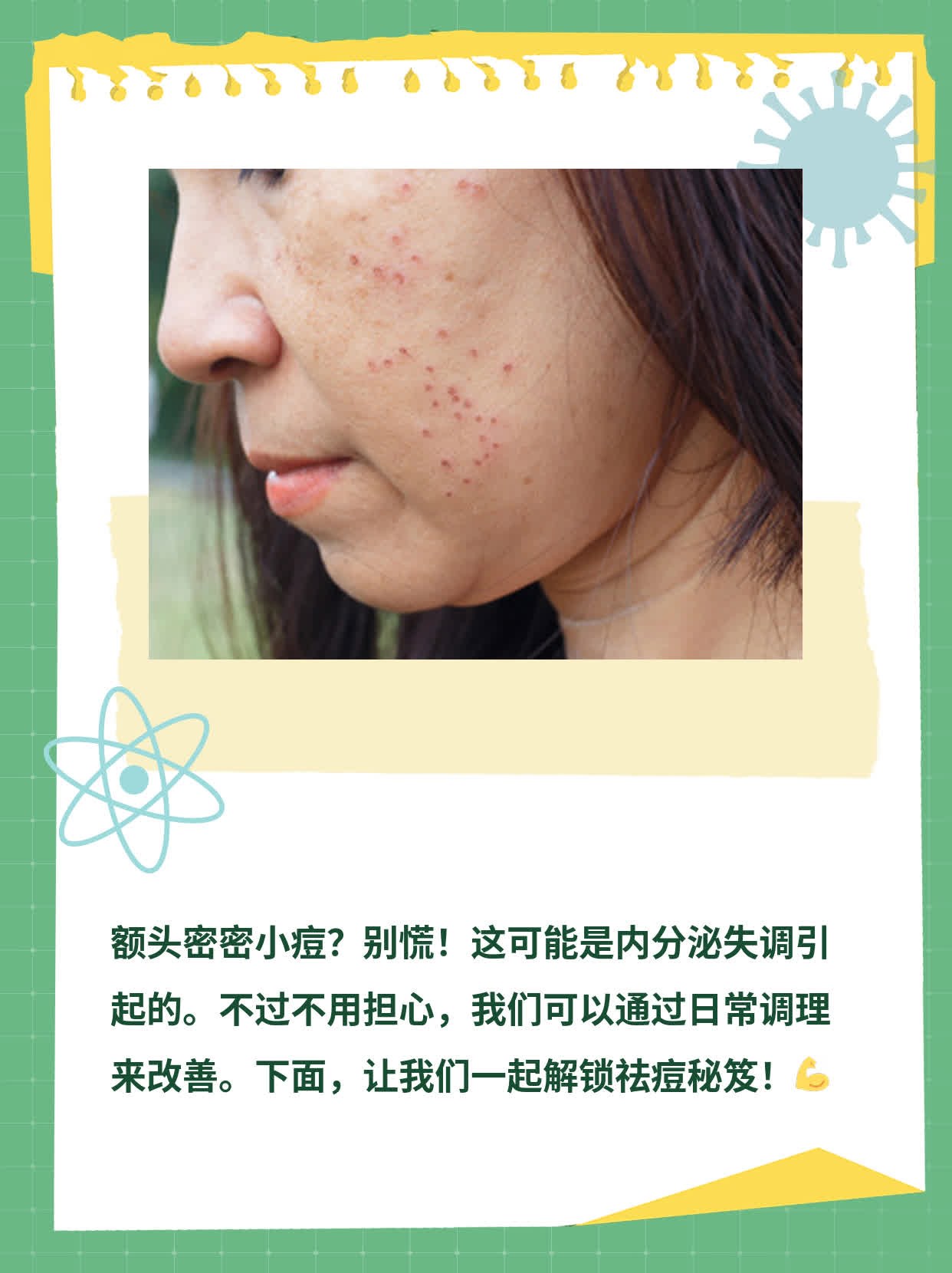 额头密密小痘？解锁祛痘秘笈！