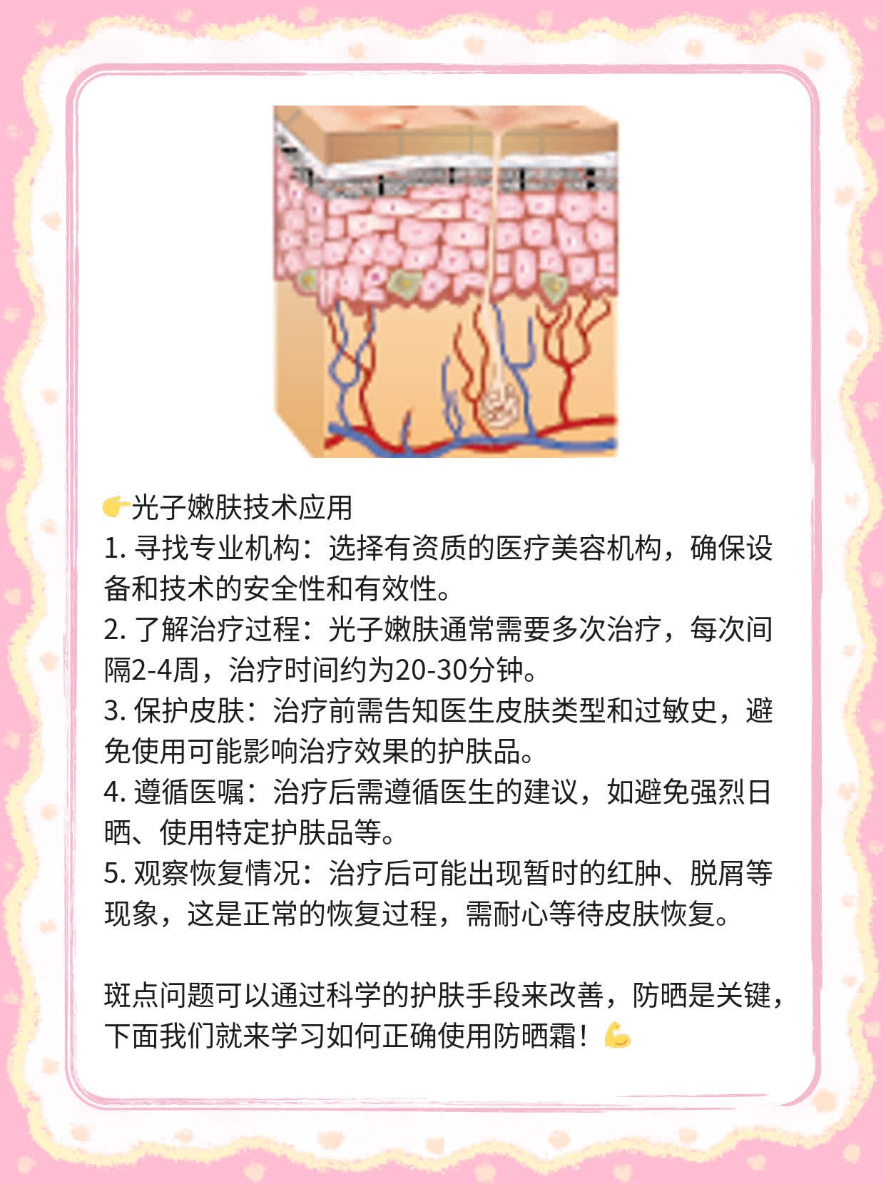 「祛斑大揭秘」晒斑、黄褐斑，这些药帮你搞定！