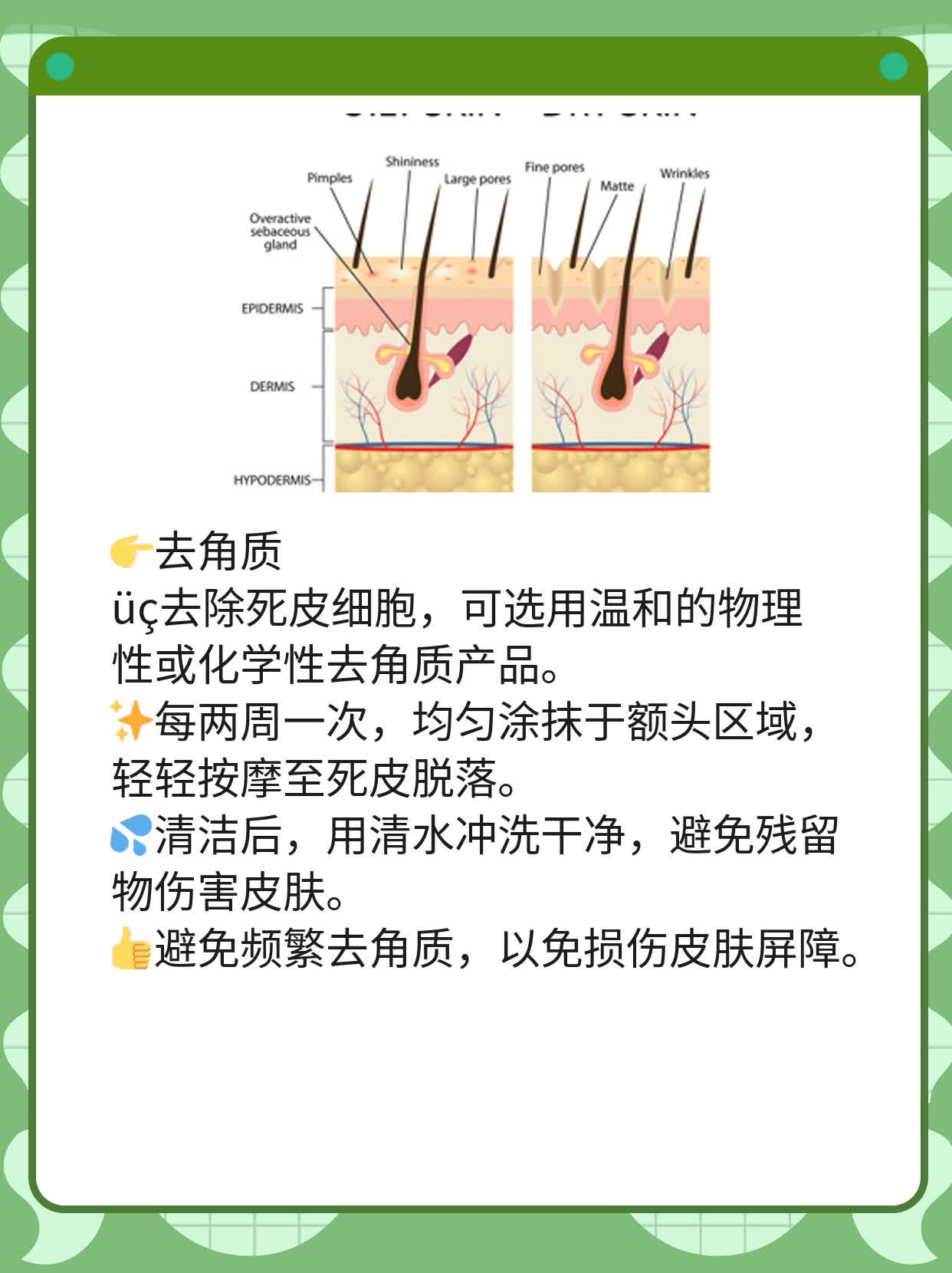 「祛痘妙招」：揪出额头上痘痘的元凶并歼灭它！