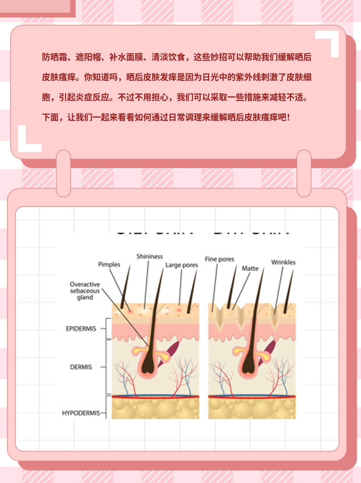 晒后皮肤瘙痒？揭秘缓解妙招！