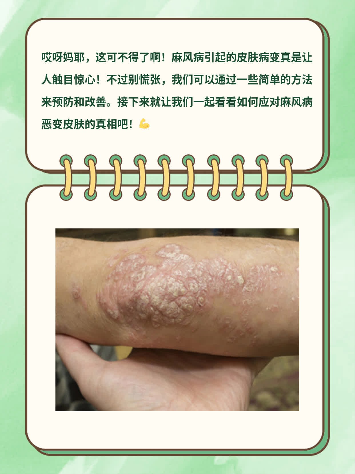 「揭秘」麻风病恶变皮肤真相：这些图让你触目惊心！