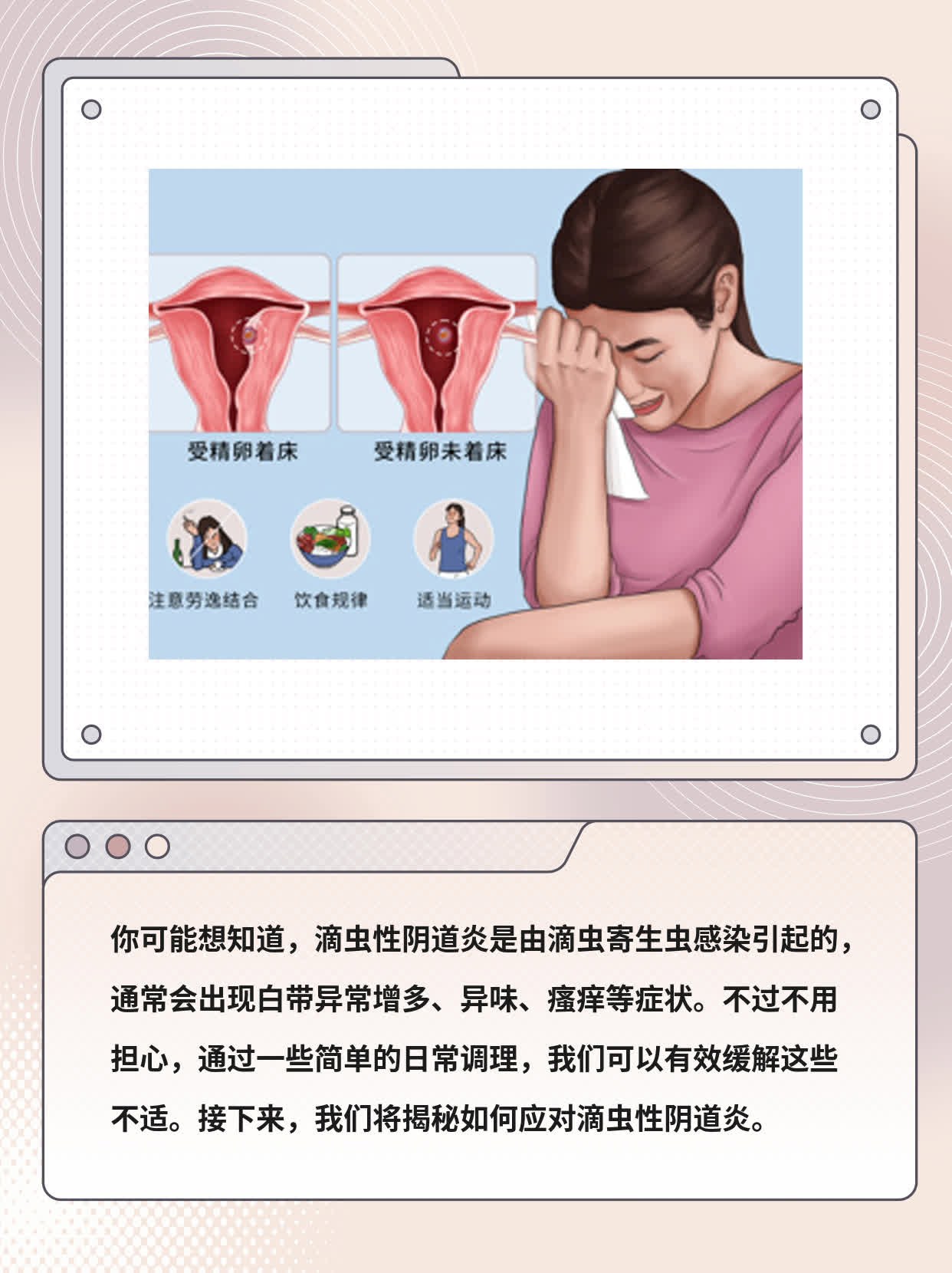 「女生私事」揭秘：如何应对滴虫性阴道炎？