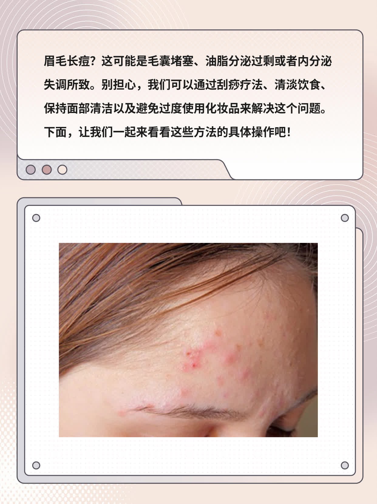 「眉毛长痘」：揪出元凶！