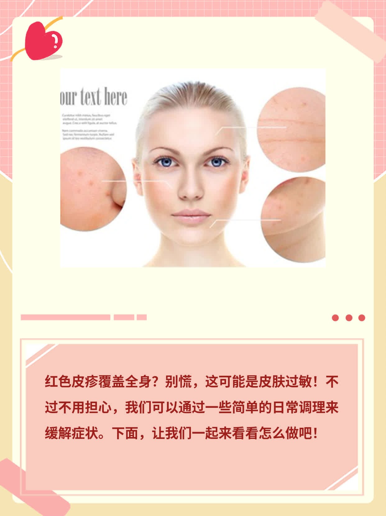 「红色皮疹覆盖全身」：揭秘皮肤大片发红真相！
