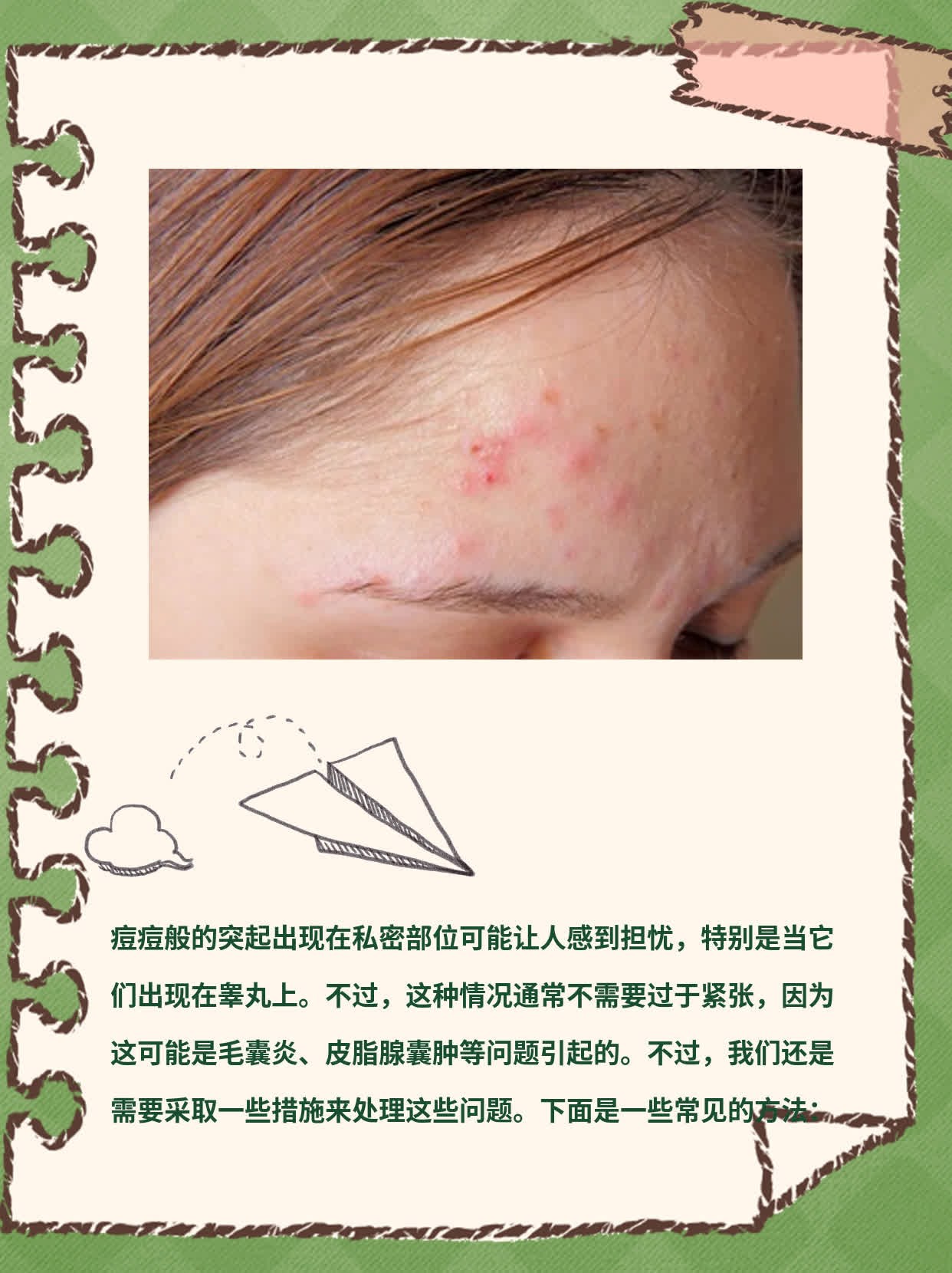 私密部位冒出小痘痘？揭秘睾丸上痘痘样突起真相！
