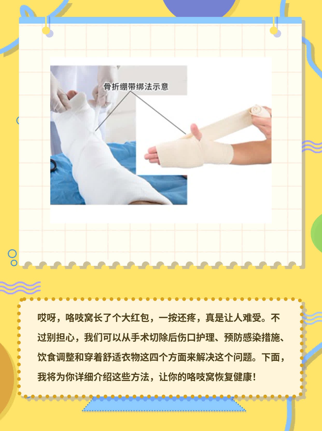 咯吱窝的大红包——处理方法分享！