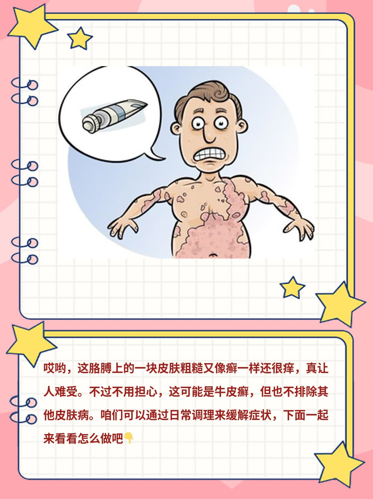 揭秘：胳膊上的『癣』状皮损真是『牛皮癬』吗？