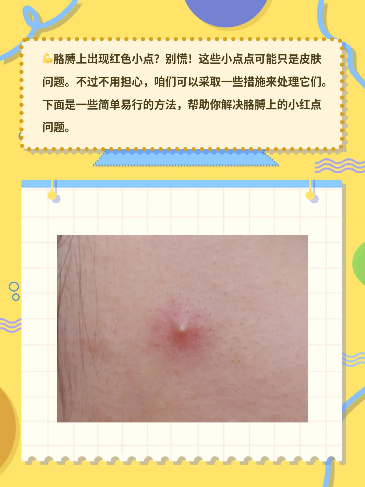 「胳膊红小点」：处理胳膊上的红色小斑点攻略