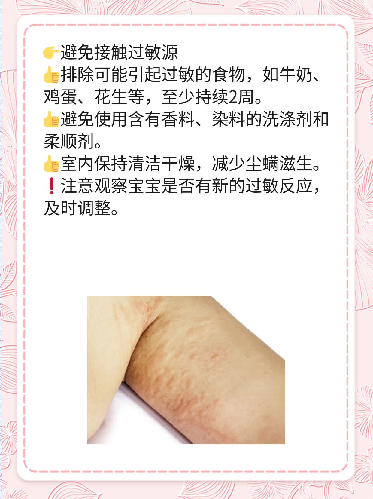 宝宝奶癣：腿部红斑图解及护理技巧