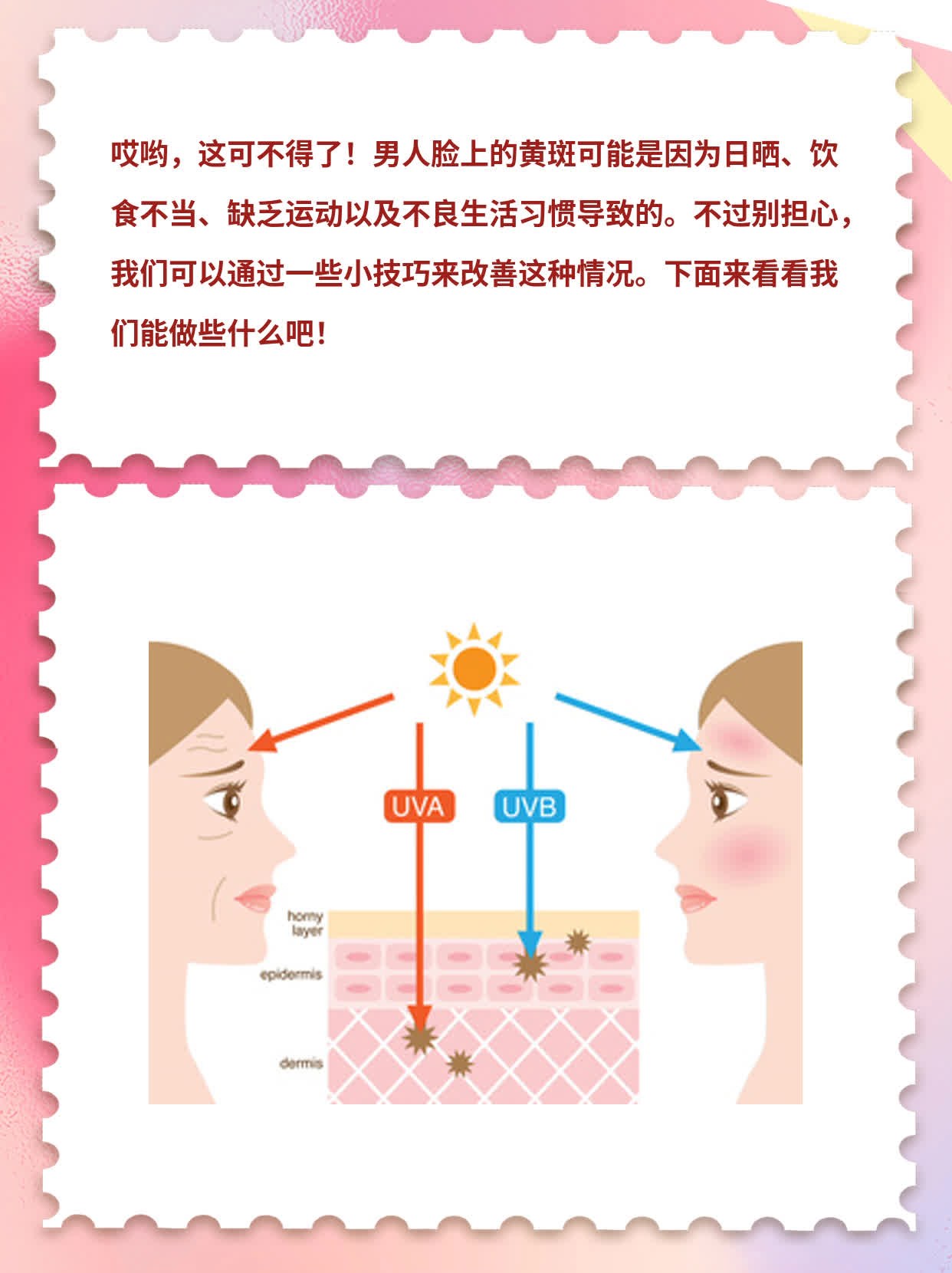 揭秘：男人脸上的黄斑成因