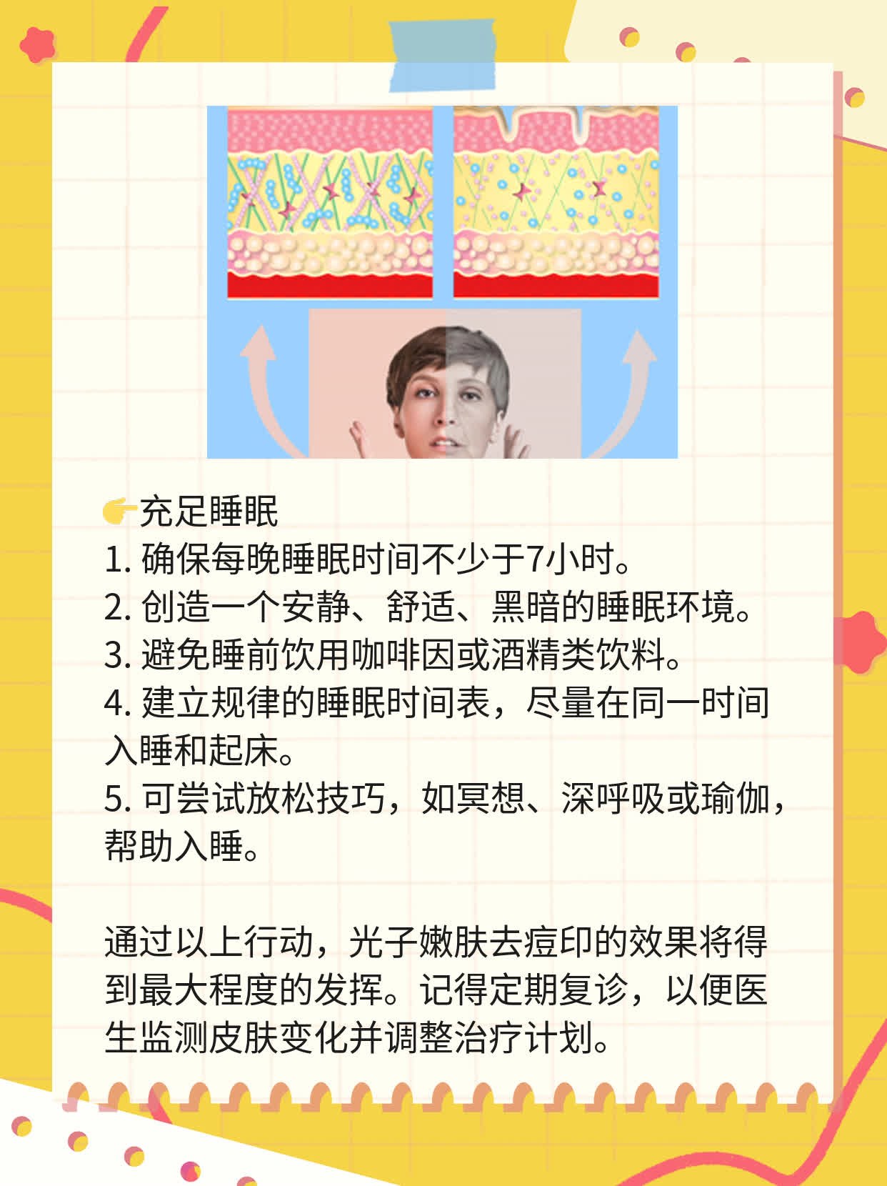 「光子嫩肤去痘印」效果如何？
