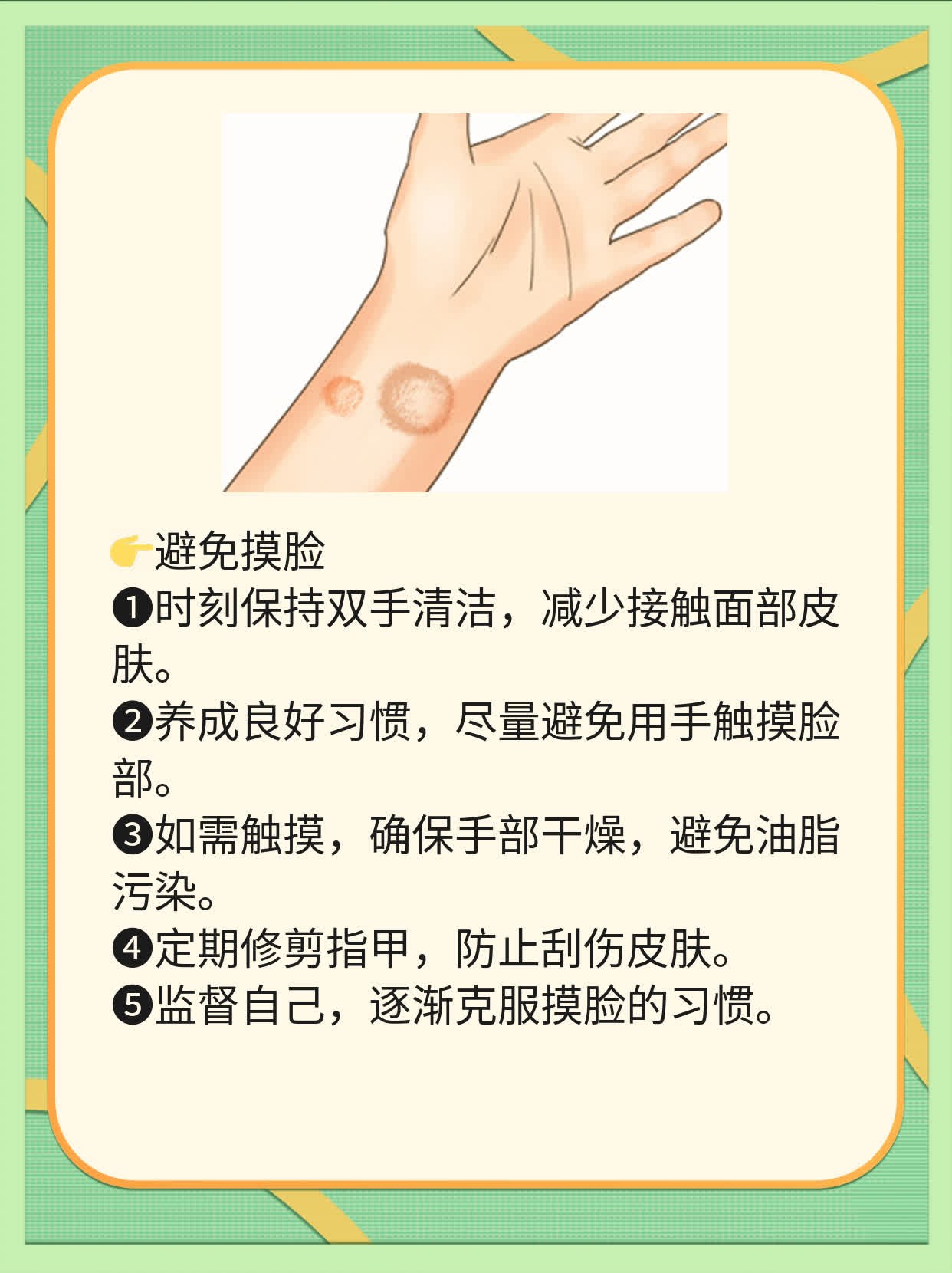 囊肿型痤疮的治疗方法大全！