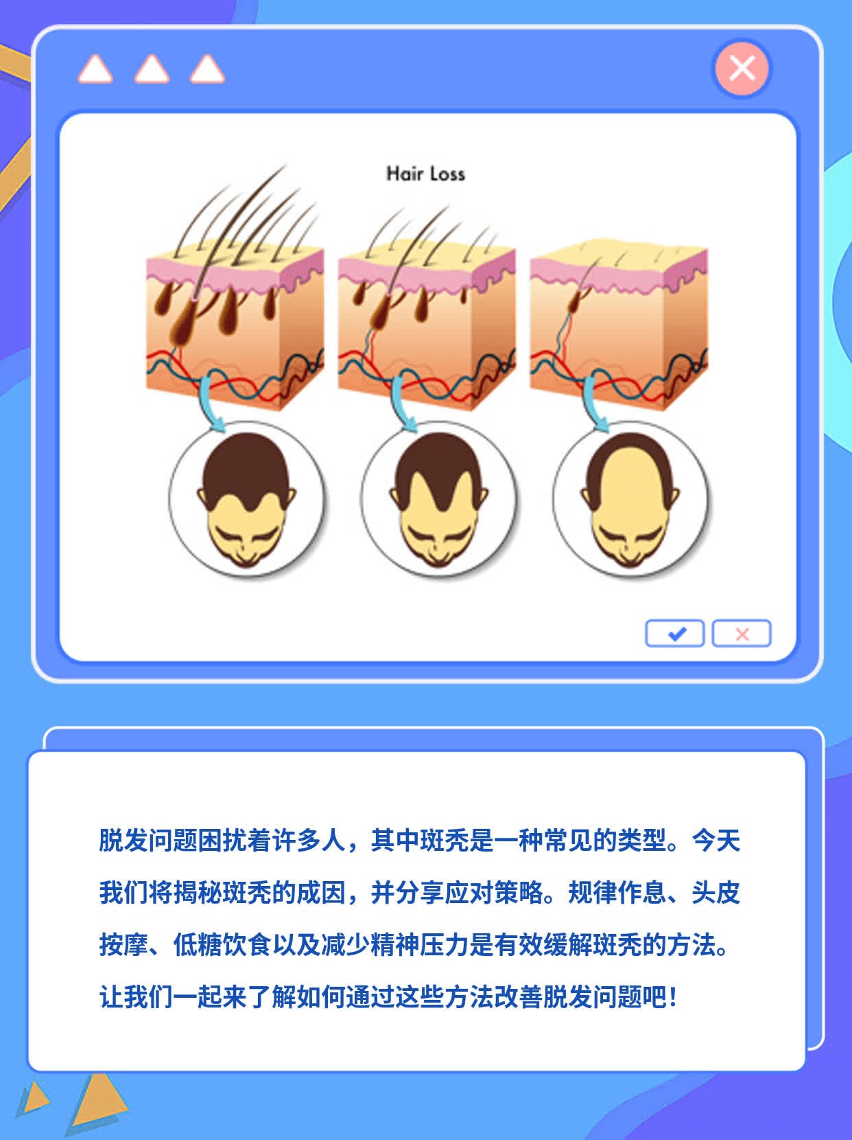 「揭秘斑秃」：探索脱发背后的主要原因及应对策略
