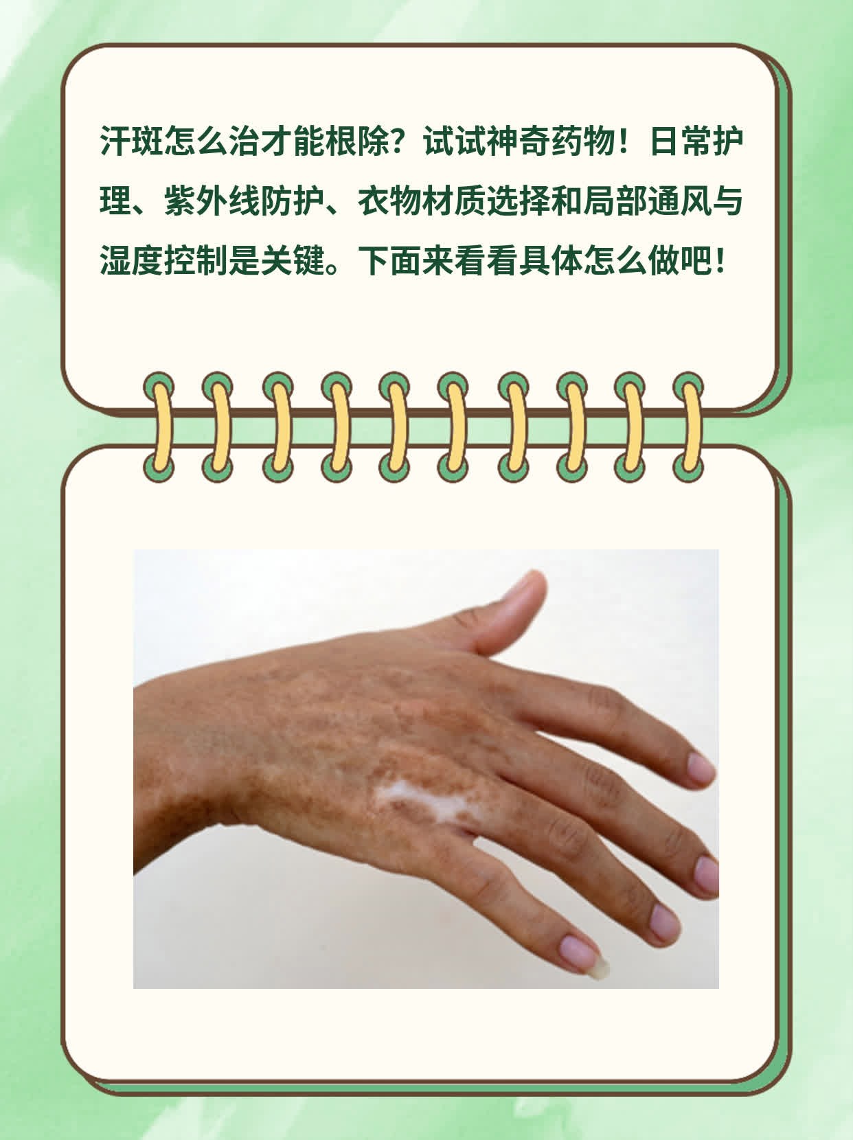 摆脱汗斑烦恼：神奇药物助你根治！