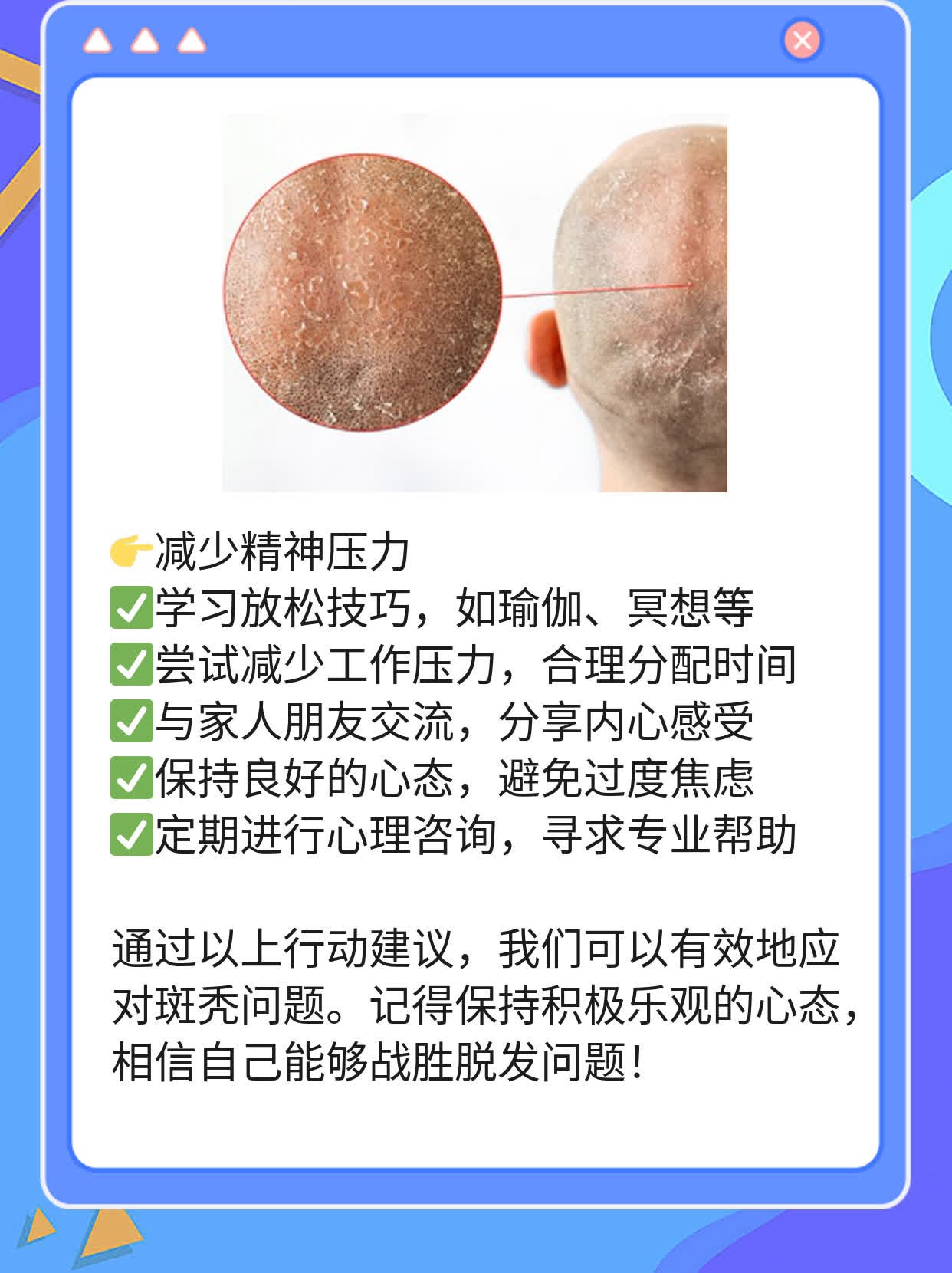 「揭秘斑秃」：探索脱发背后的主要原因及应对策略