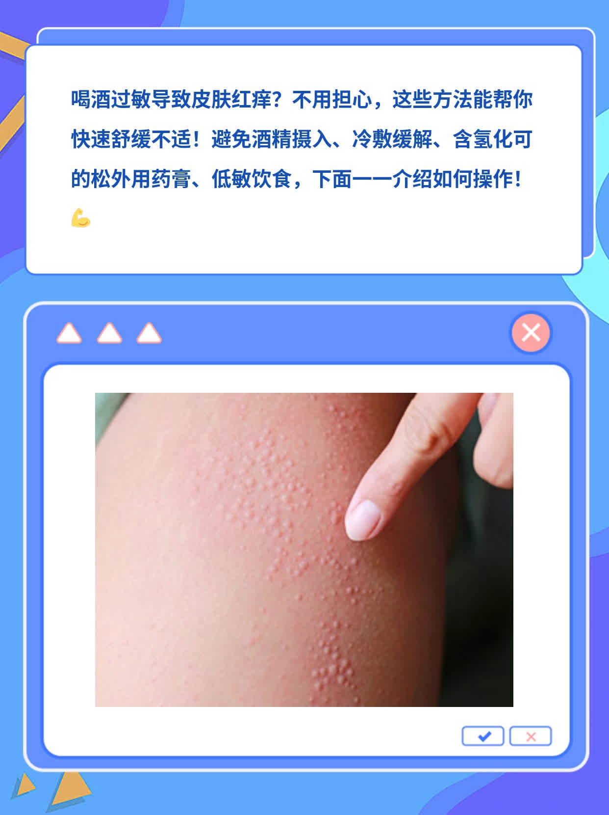 摆脱酒精不耐受引起的皮肤红痒：简易解决方案！