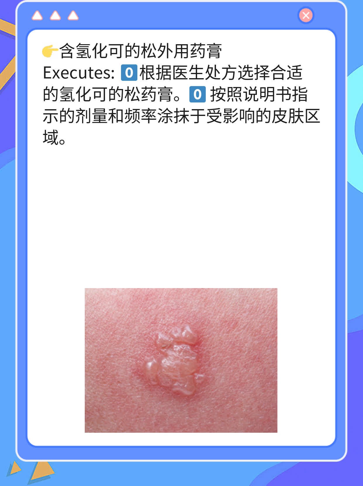 摆脱酒精不耐受引起的皮肤红痒：简易解决方案！