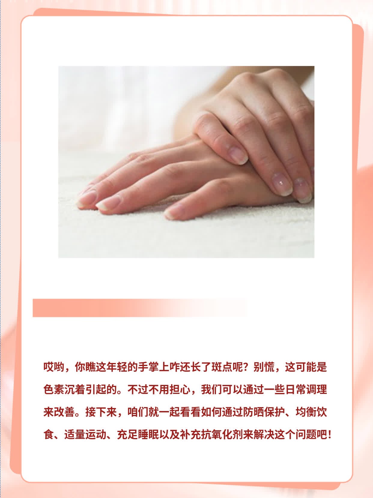 揭秘：年轻手掌长斑的原因！