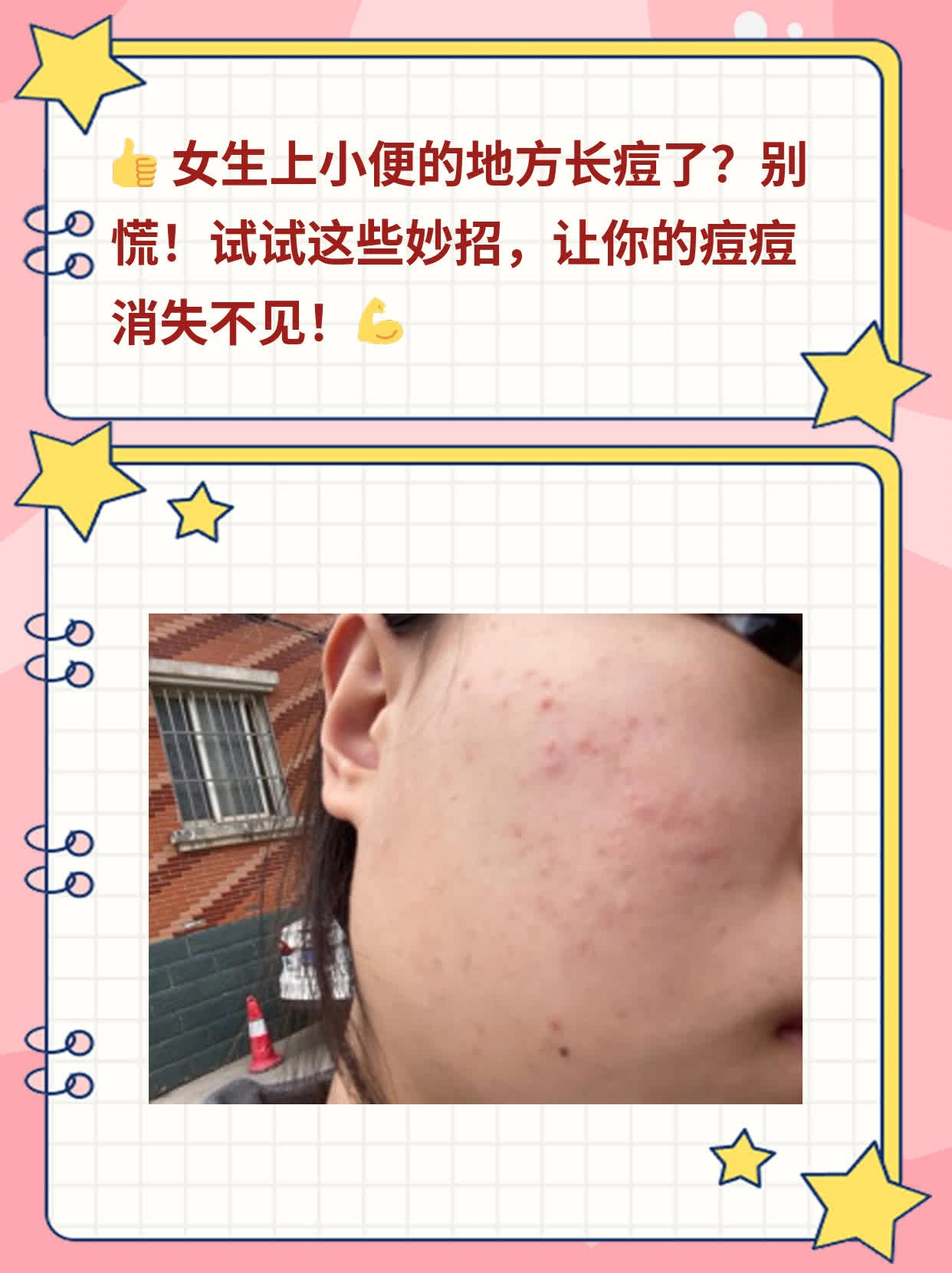 「有救！女生厕所痘痘」：拯救厕所痘痘攻略