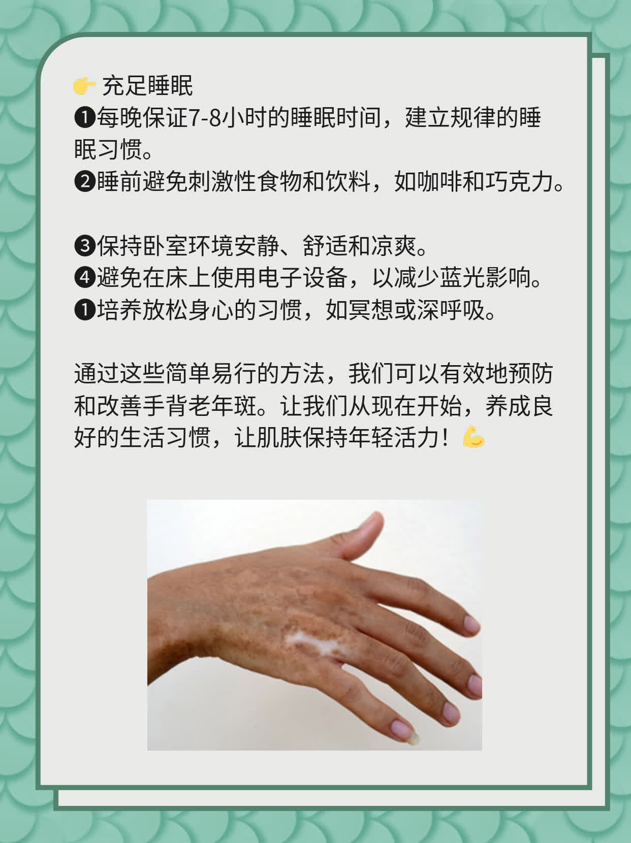 「手背老年斑」：揭秘老年斑形成原因及处理方法！