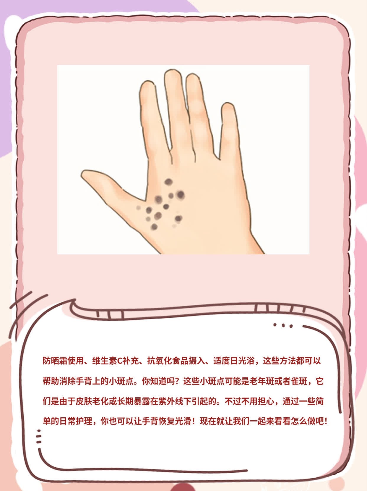 「手背长小斑点」原因揭秘：如何消除？
