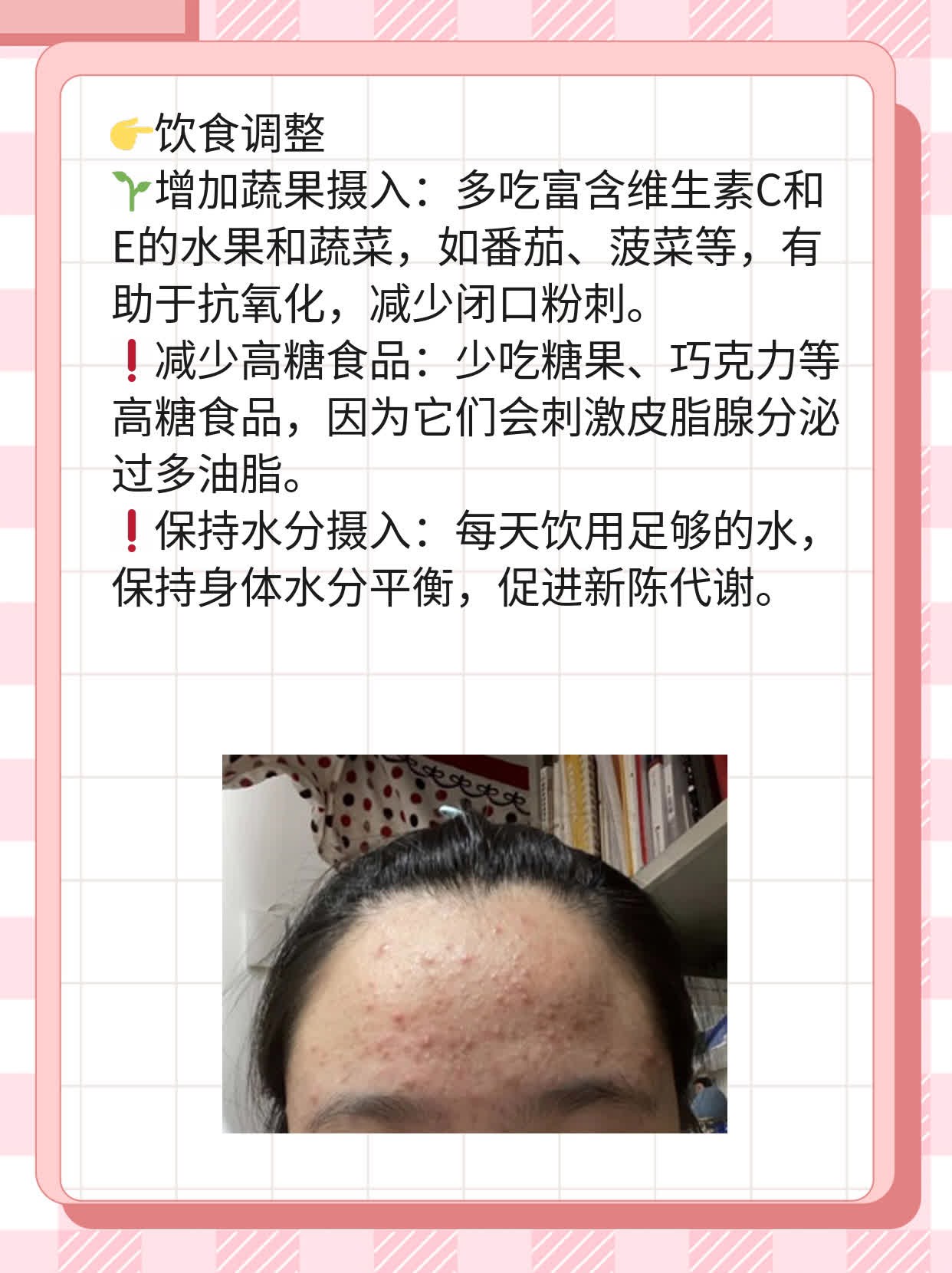揭秘：后背黑硬小石头竟是闭口粉刺？！