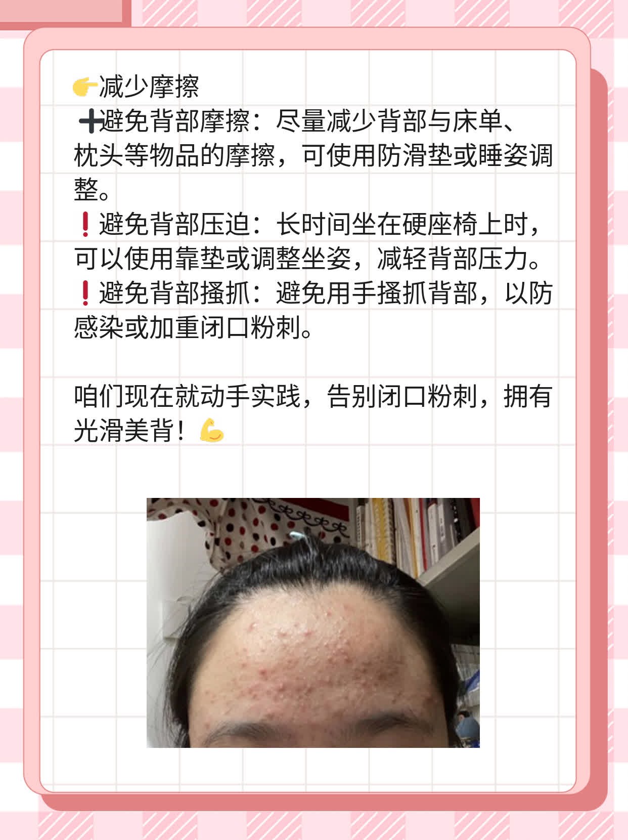 揭秘：后背黑硬小石头竟是闭口粉刺？！