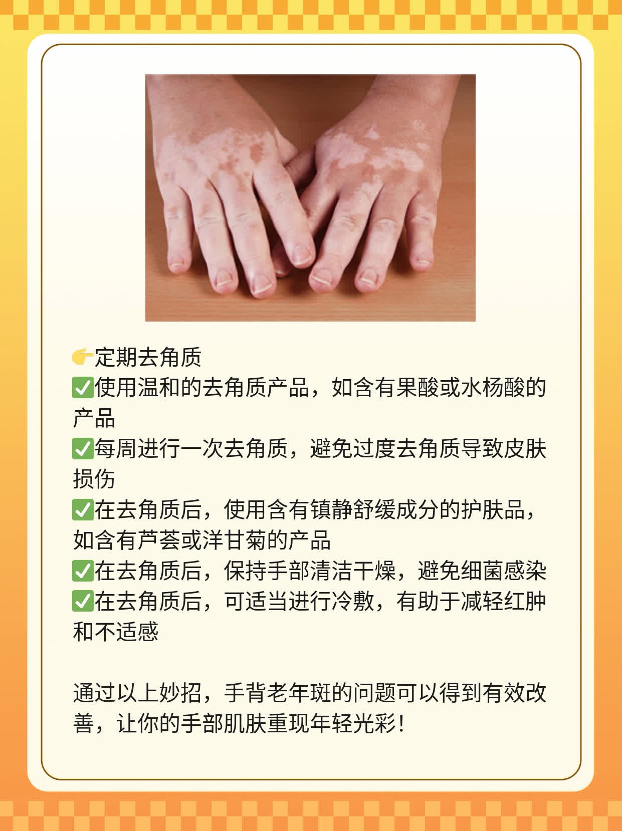 「手背老年斑」妙招：不留痕迹去斑术！