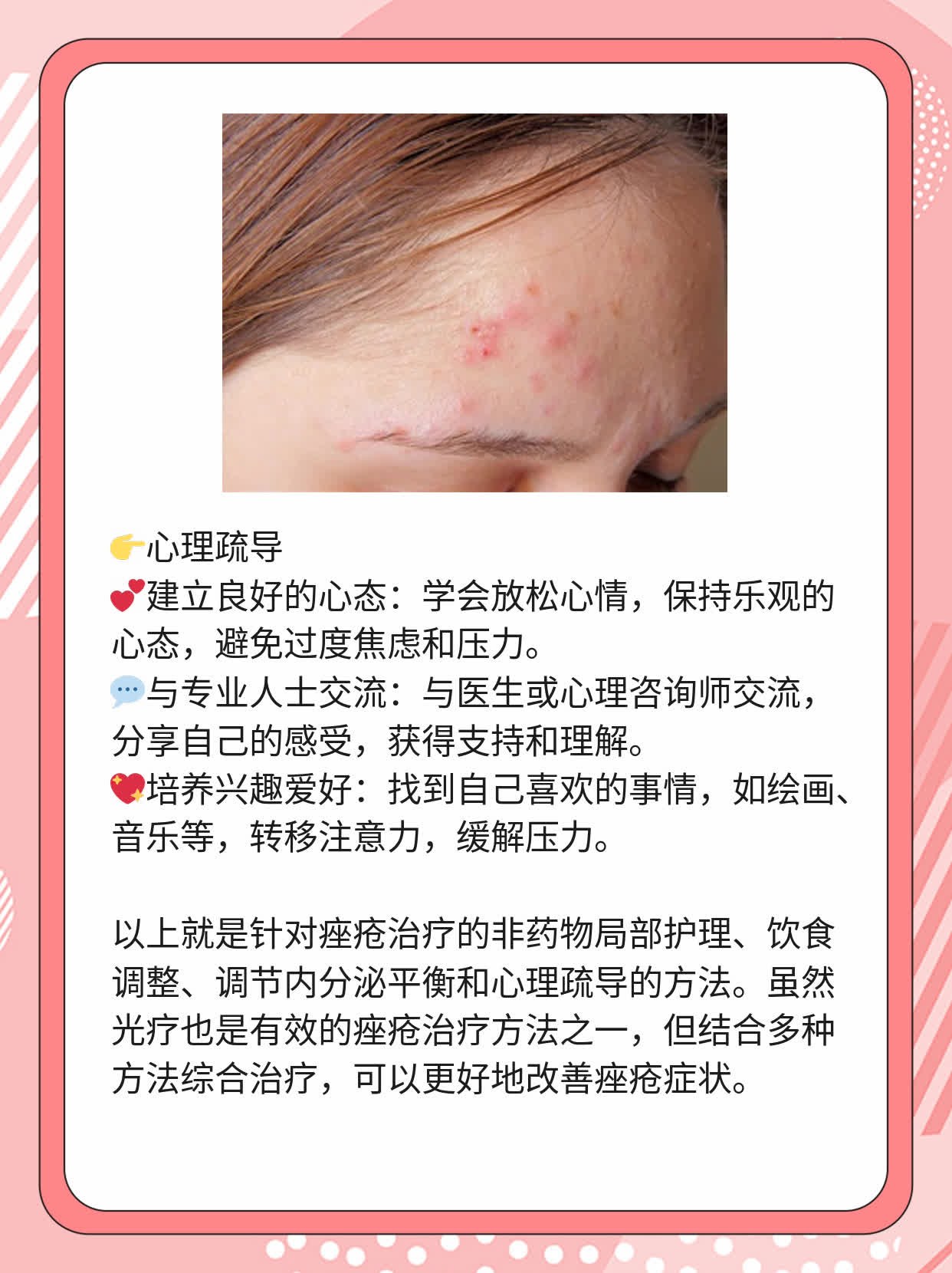 痤疮治疗：红光VS蓝光，哪个更胜一筹？