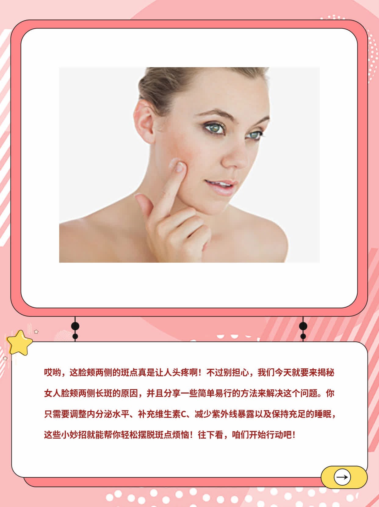 揭秘：女人脸颊两侧长斑的原因！