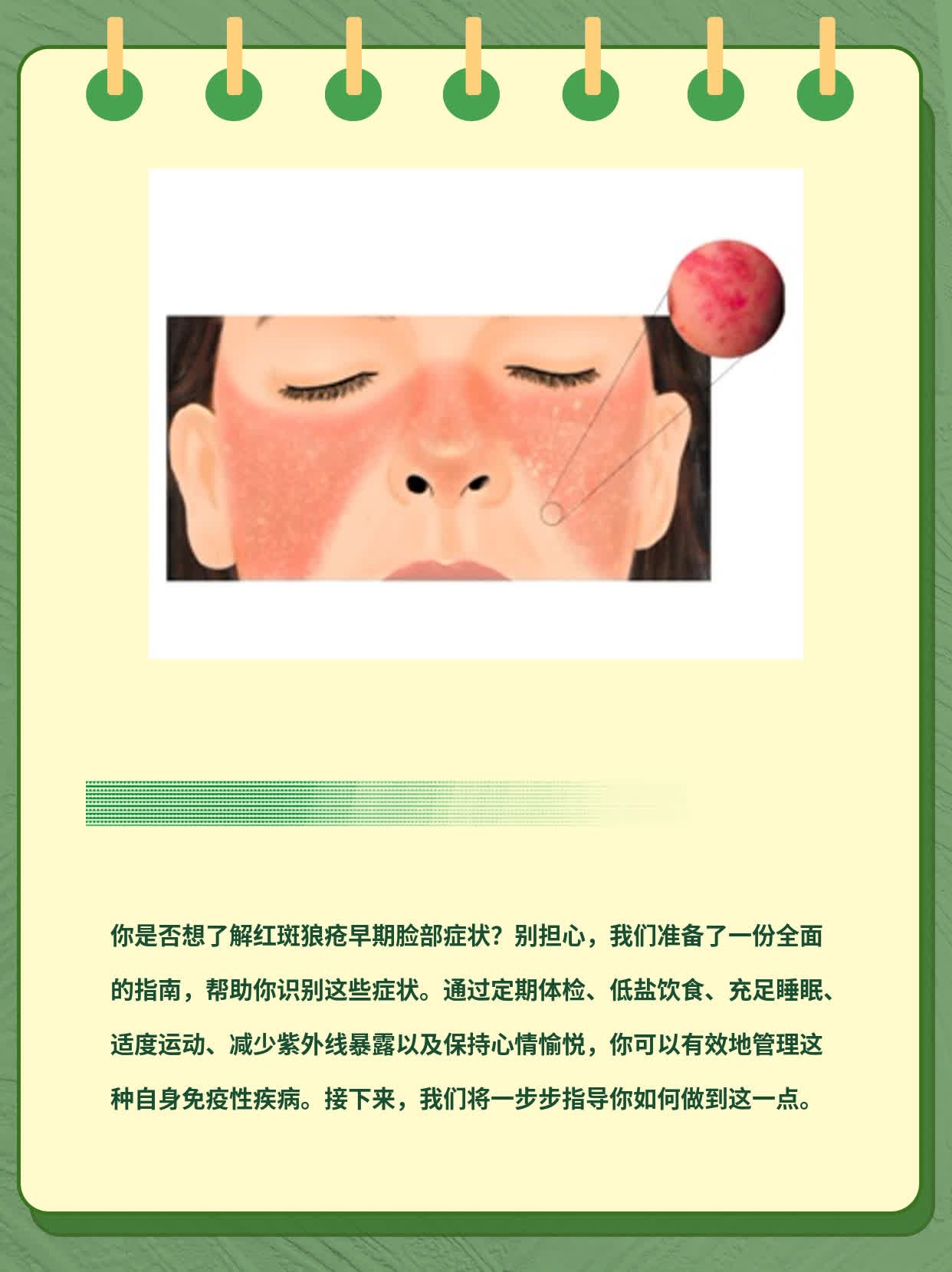 「经验分享」识破红斑狼疮：早期脸部症状图解