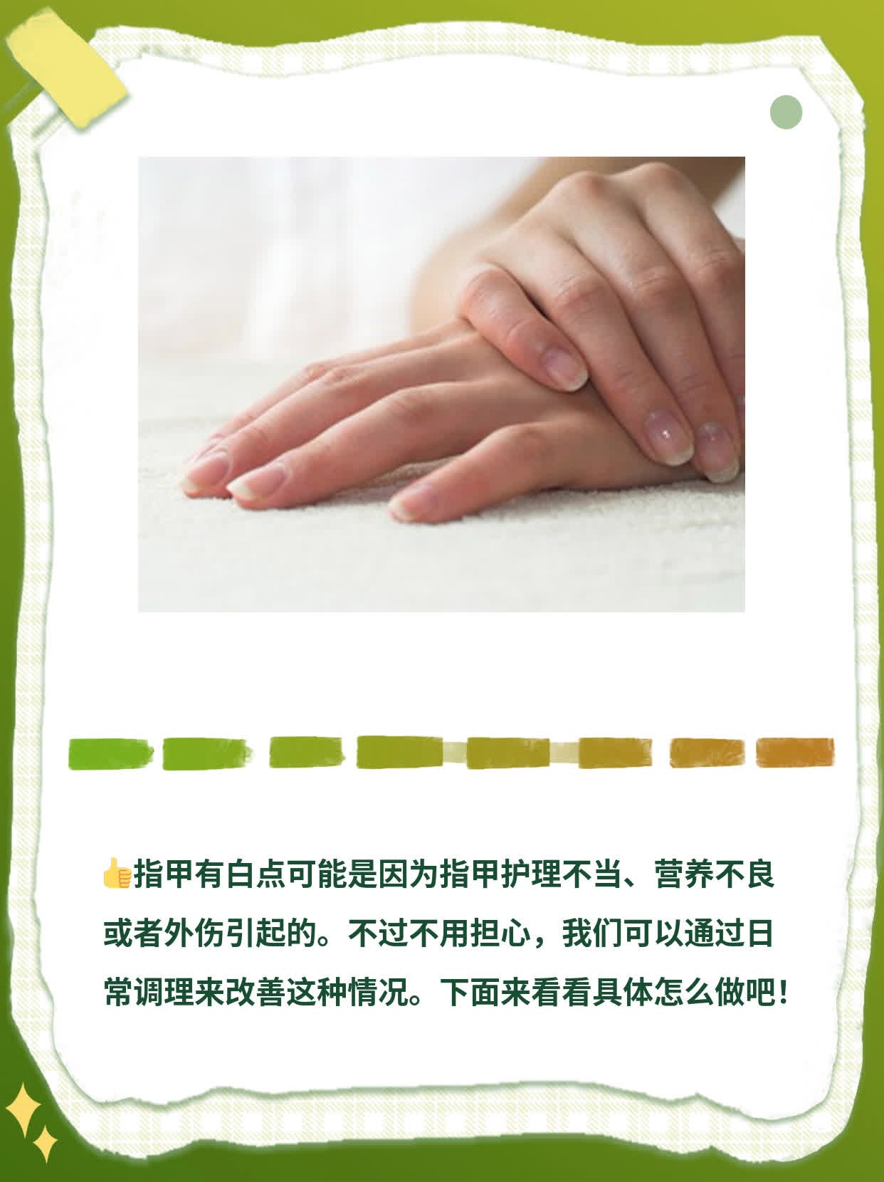 「指甲有白点」的原因探秘