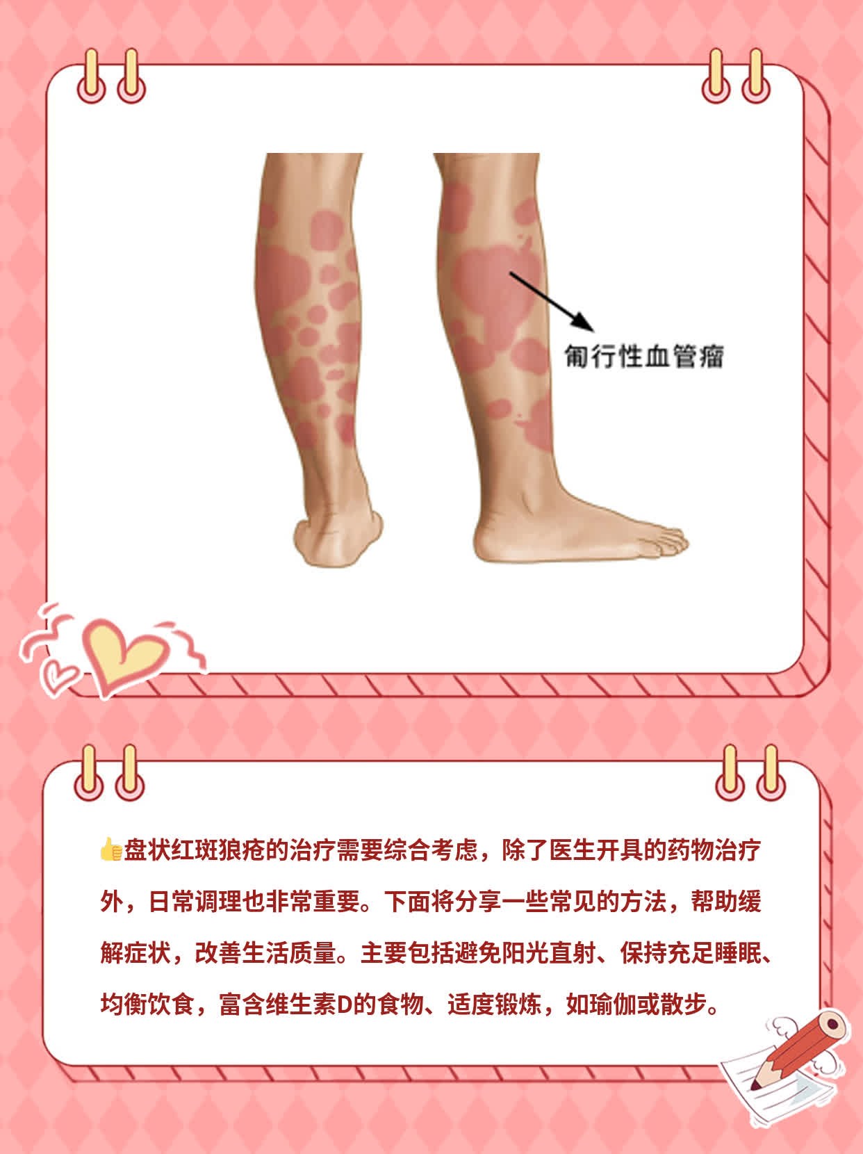 「经验分享」盘状红斑狼疮最佳疗法探秘