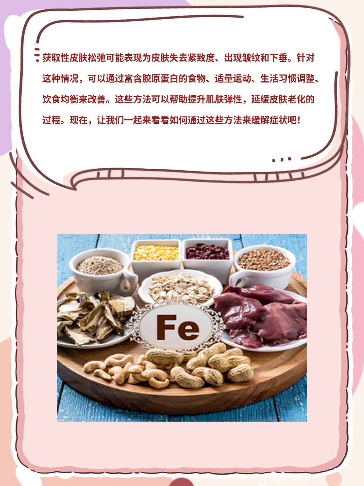「获取性皮肤松弛」的症状解析