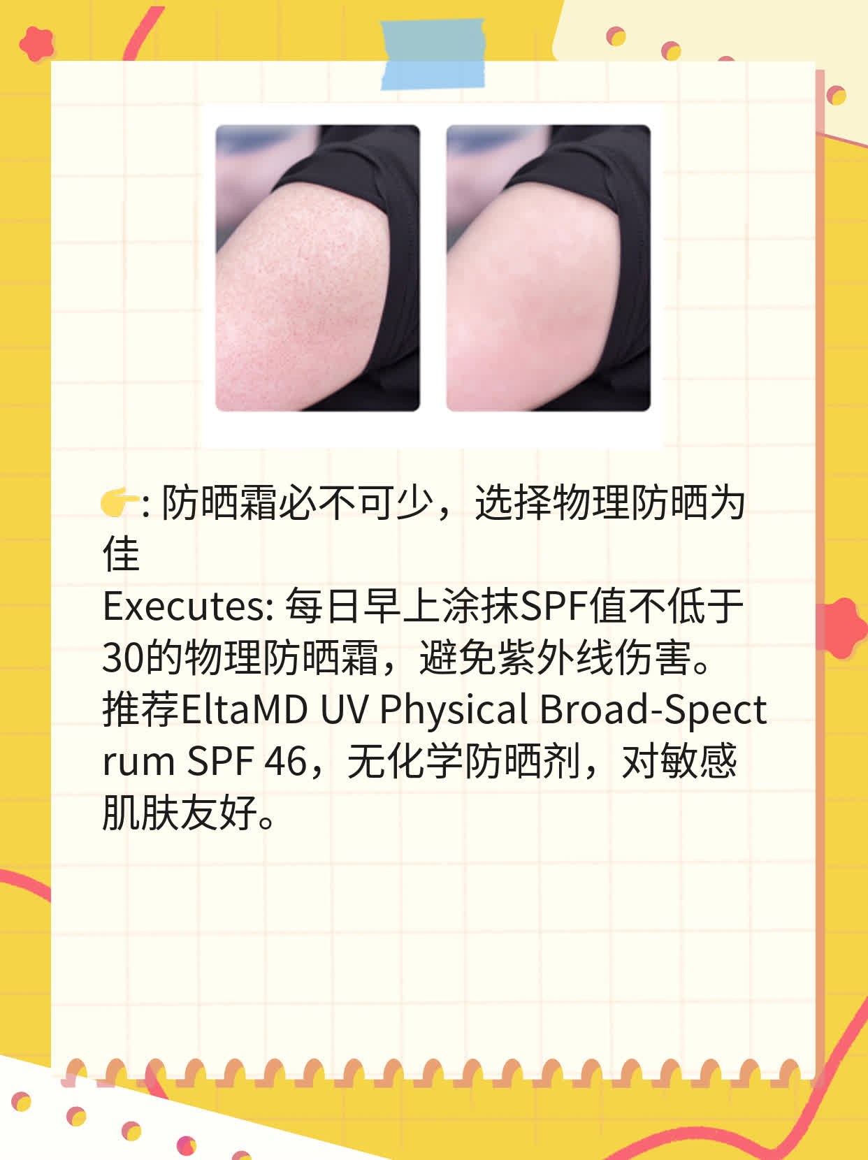 肌肤出油少却长痘？探秘你的真正肤质！