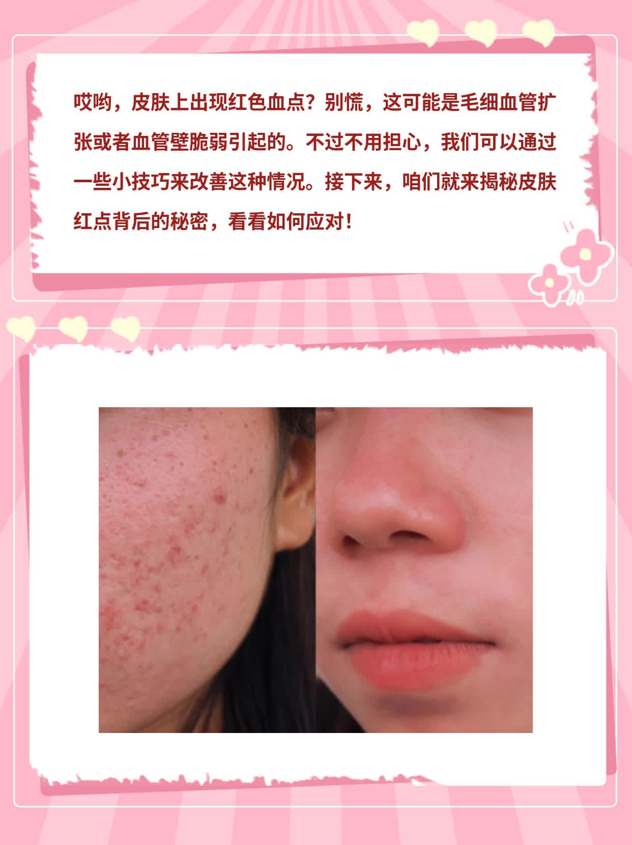 揭秘：皮肤红点背后的秘密！