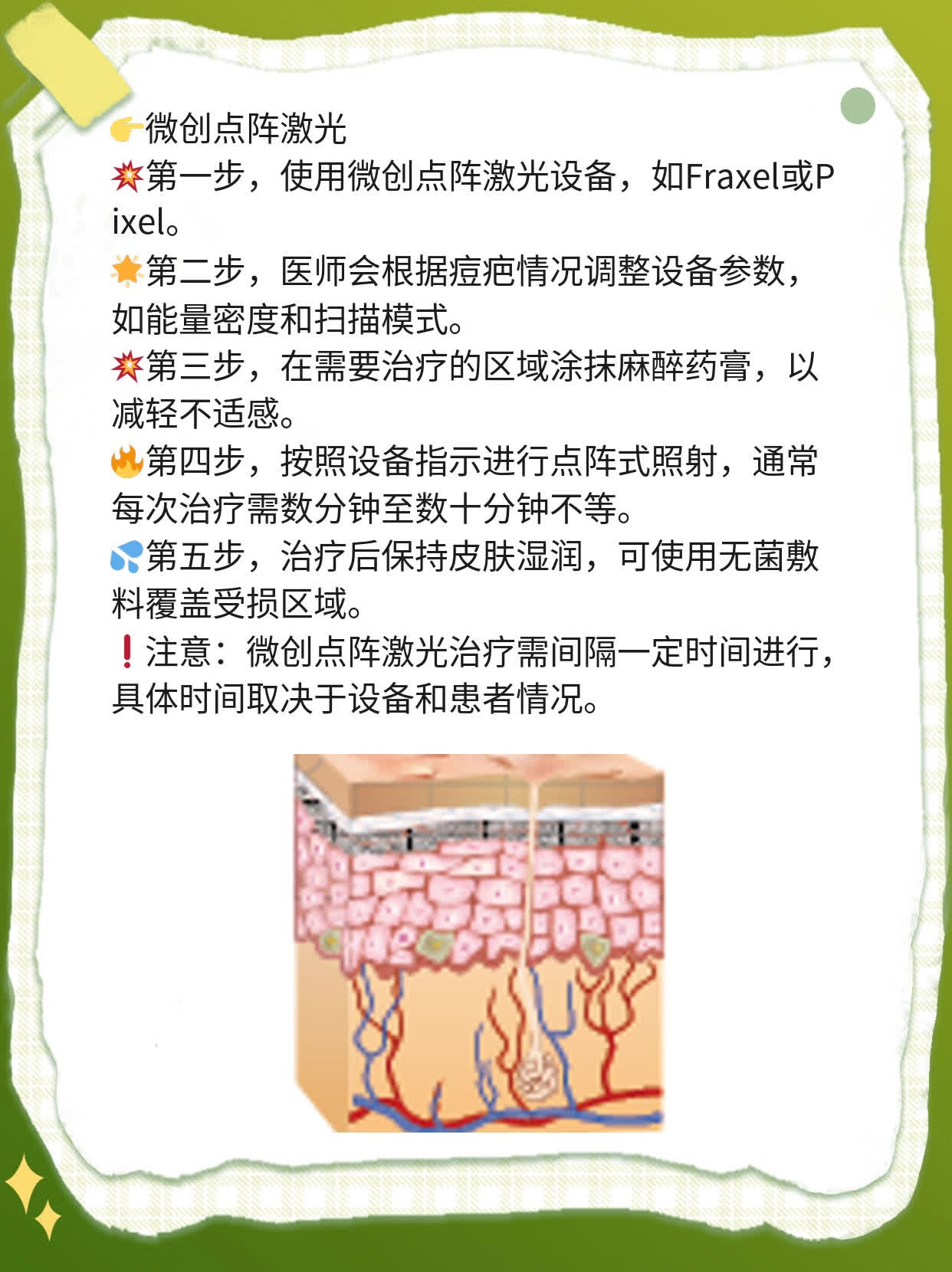 「揭秘」激光祛疤技术大揭密：X次治疗搞定难缠痘疤！