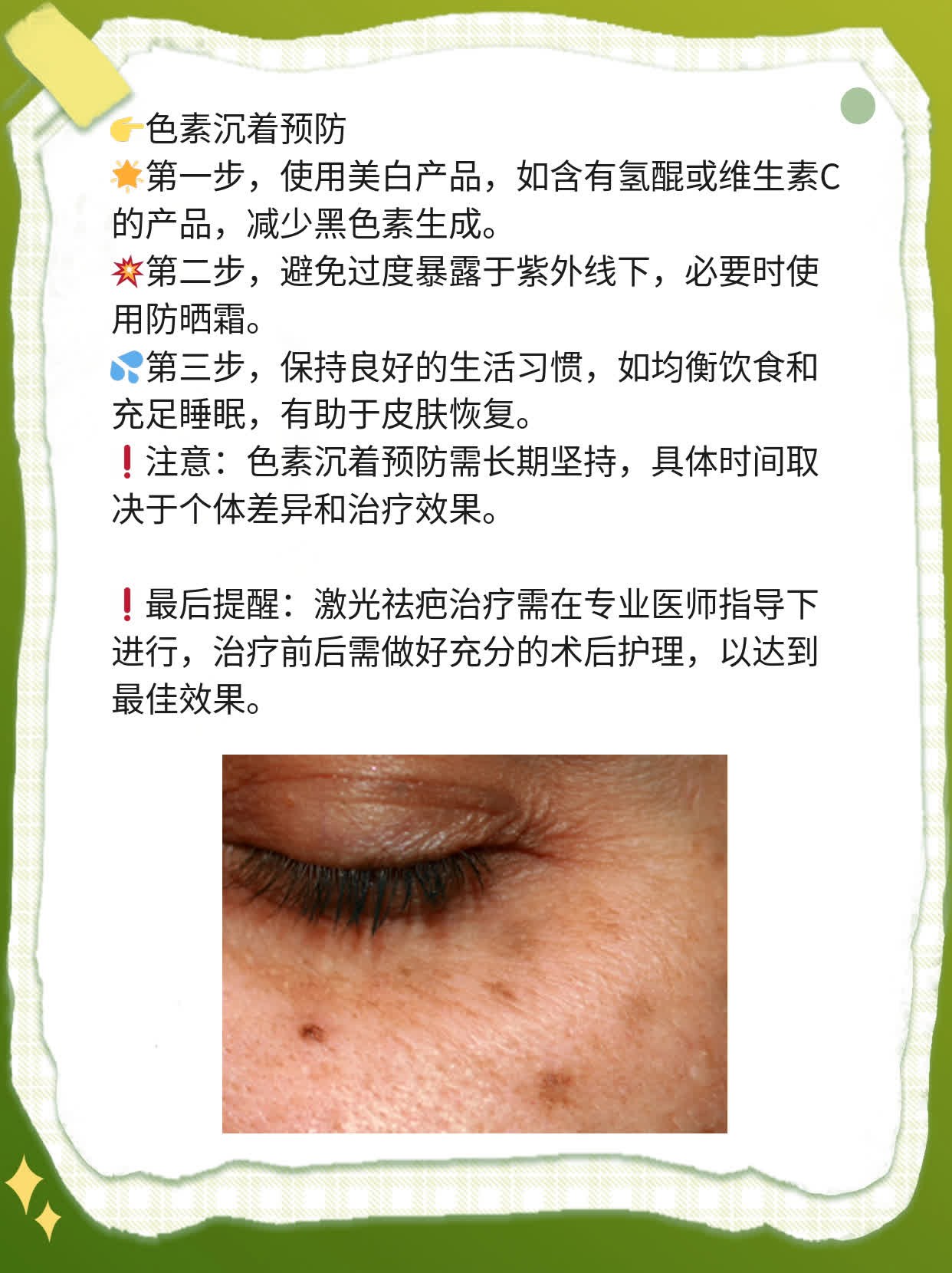 「揭秘」激光祛疤技术大揭密：X次治疗搞定难缠痘疤！