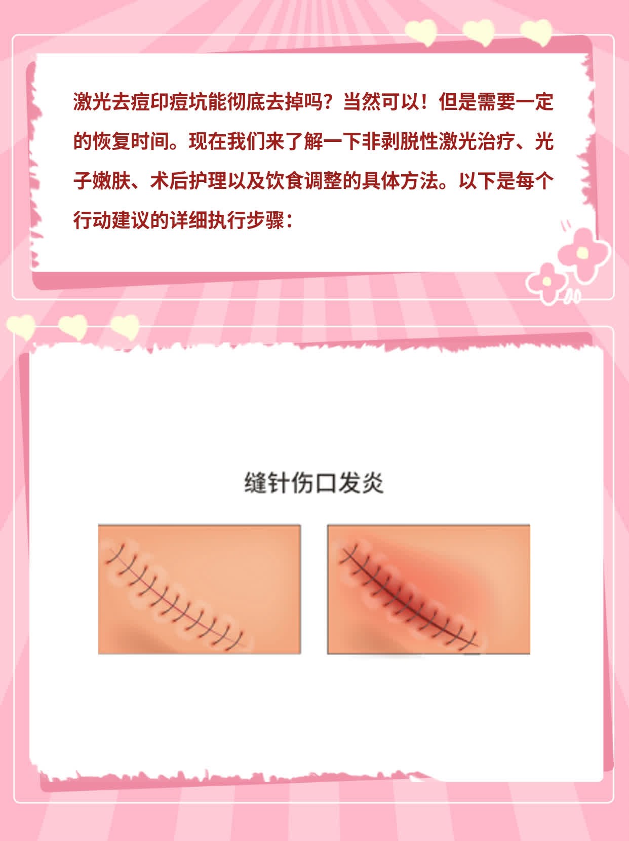 激光去痘印痘坑效果揭秘！