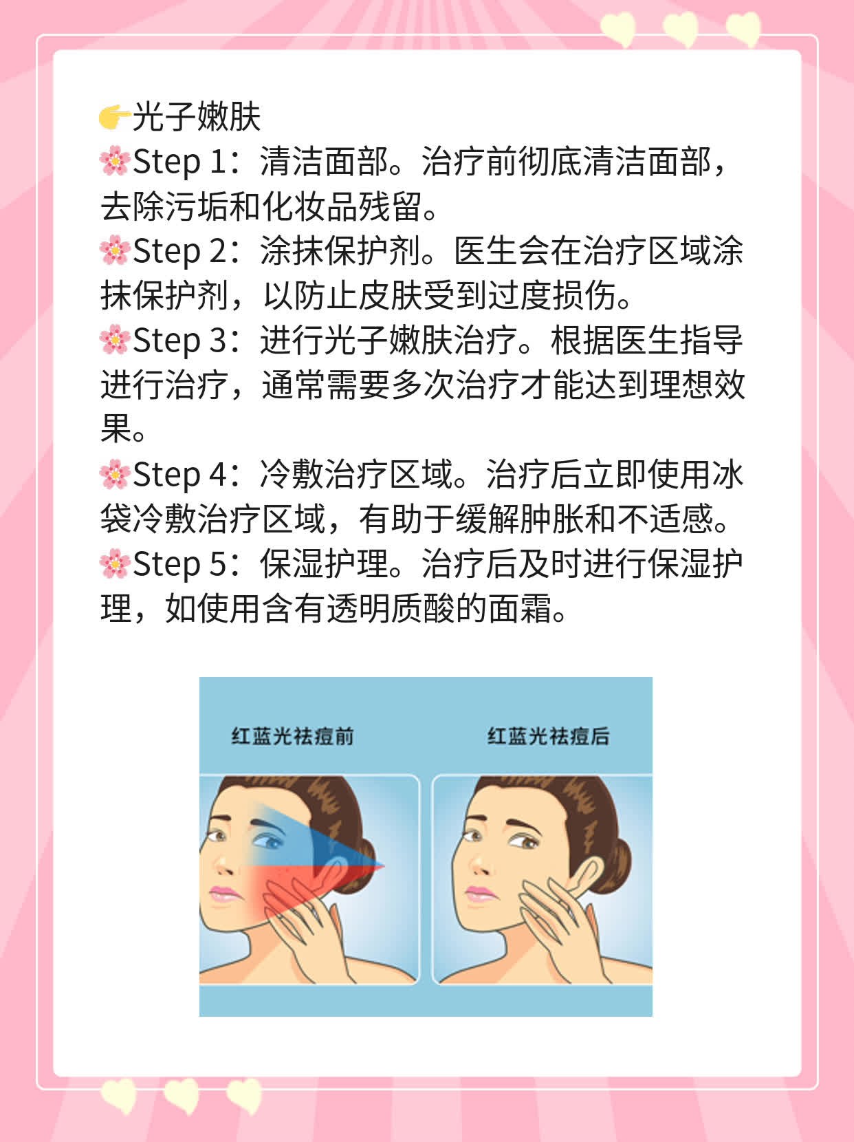 激光去痘印痘坑效果揭秘！