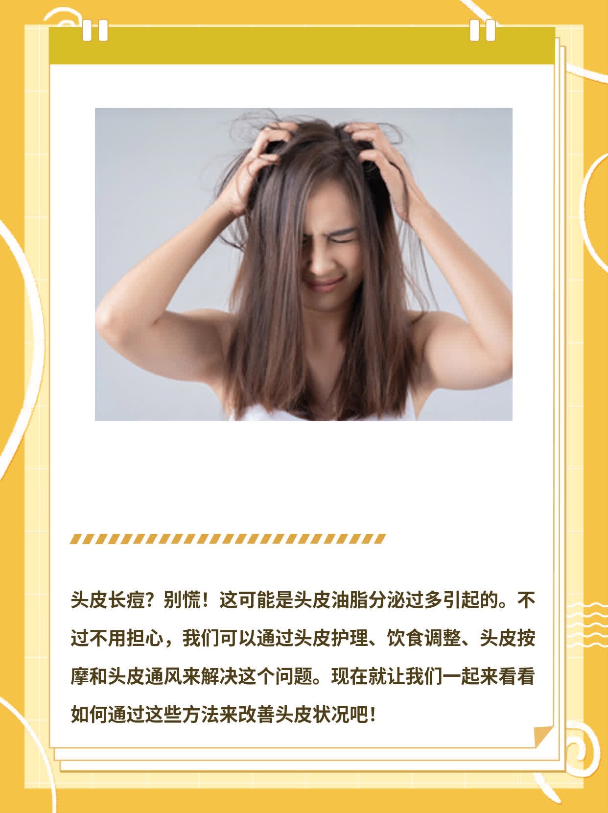 「头皮长痘」：揪出元凶&拯救计划！