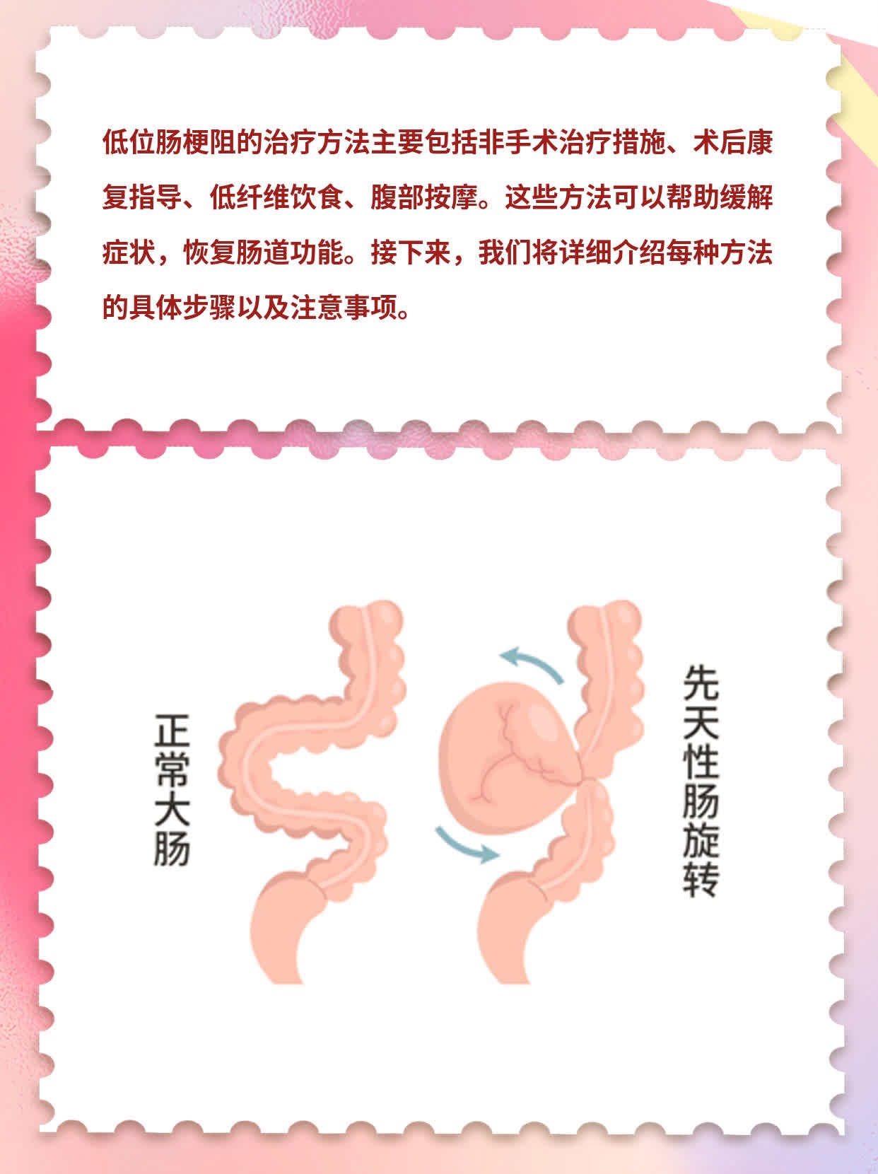 不完全梗阻怎样才算好了