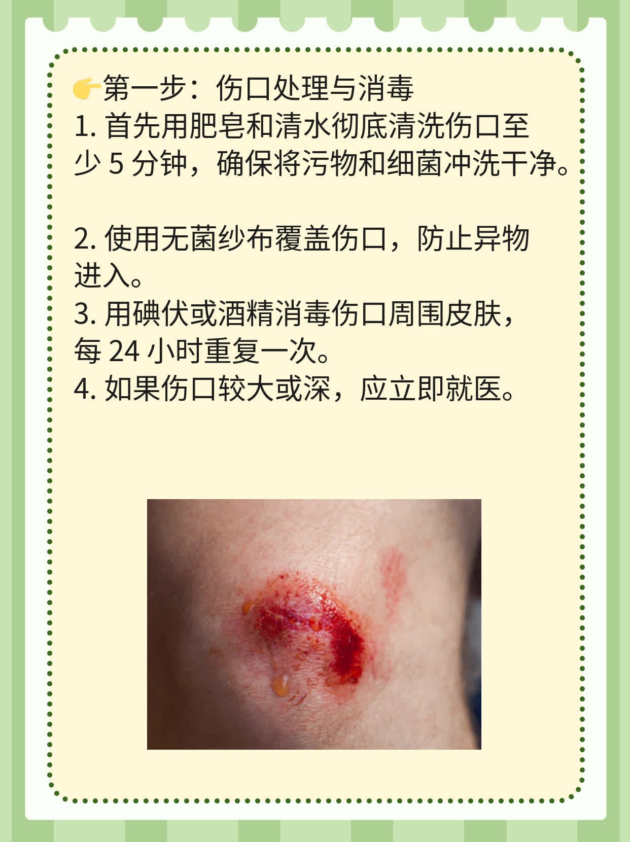 「被猫抓出血」了，打针有必要吗？