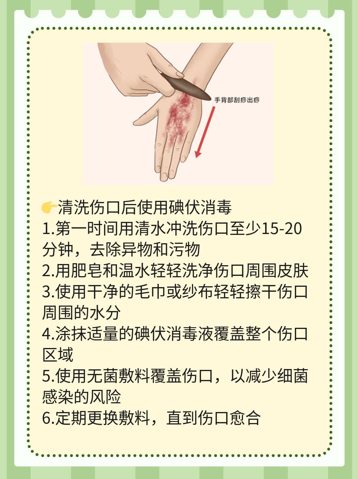 「有图有真相」：自家狗狗咬伤出血后的应急处理法