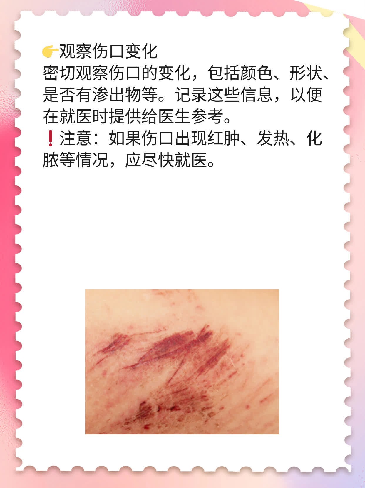 「有图有真相」：被猫咬出血后的正确操作指南！