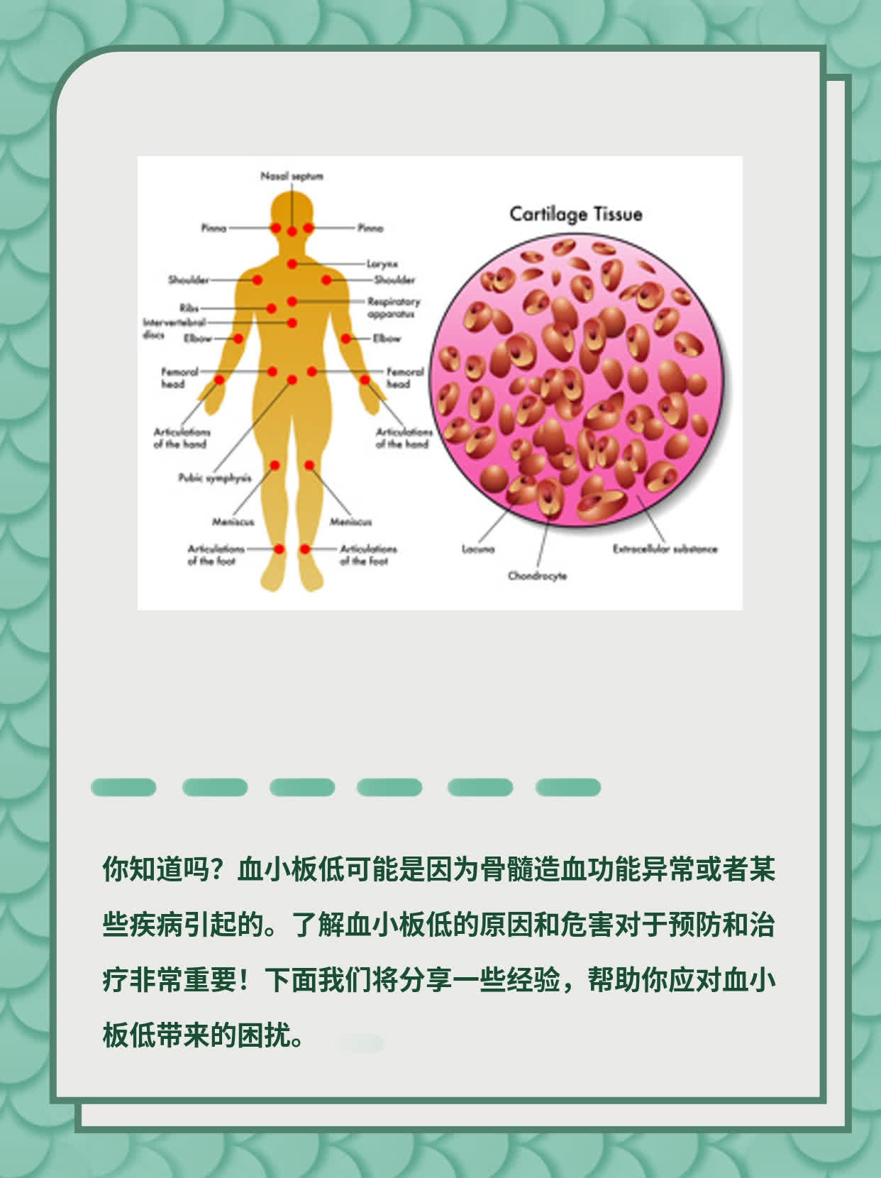 揭秘血小板低的原因及危害！经验分享