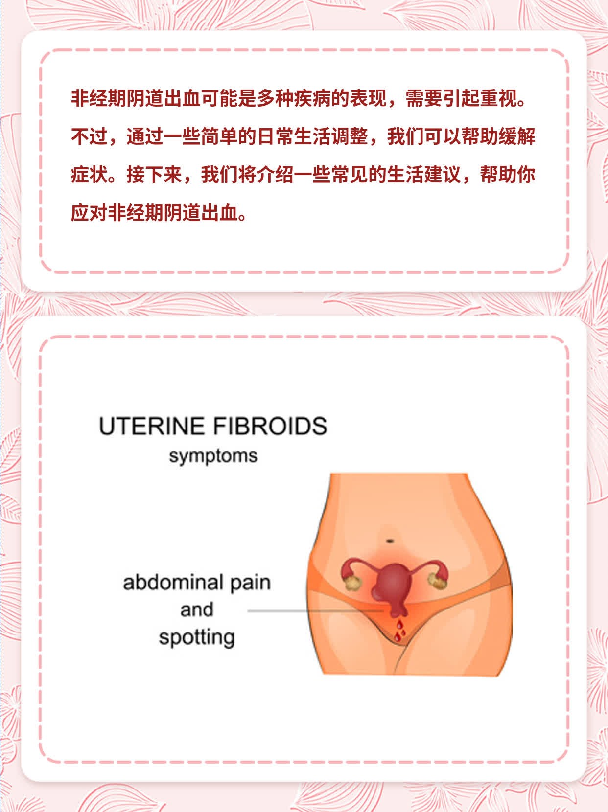 「非经期阴道出血」——你不可不知的小秘密！